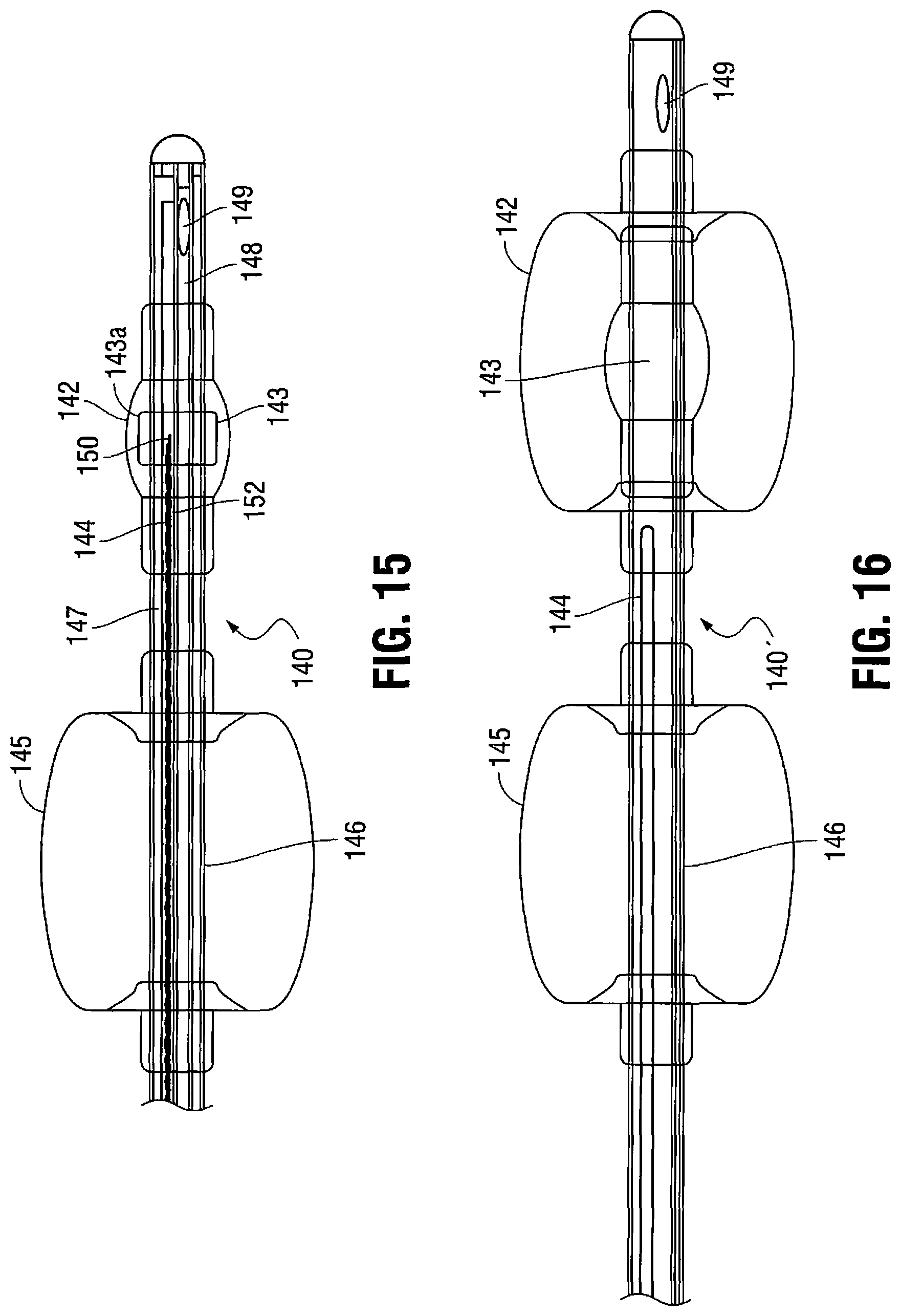 Patent US11779263 Figure 11 – Catheter for monitoring intra-abdominal pressure for assessing preeclampsia