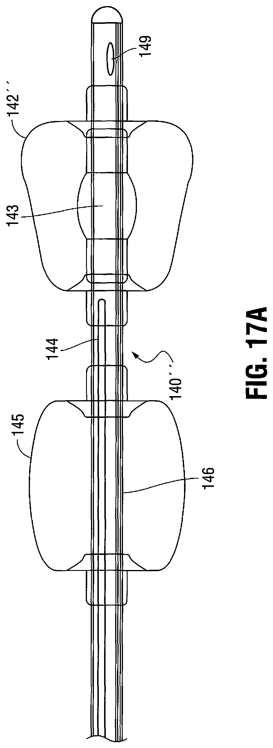 Patent US11779263 Figure 12 – Catheter for monitoring intra-abdominal pressure for assessing preeclampsia