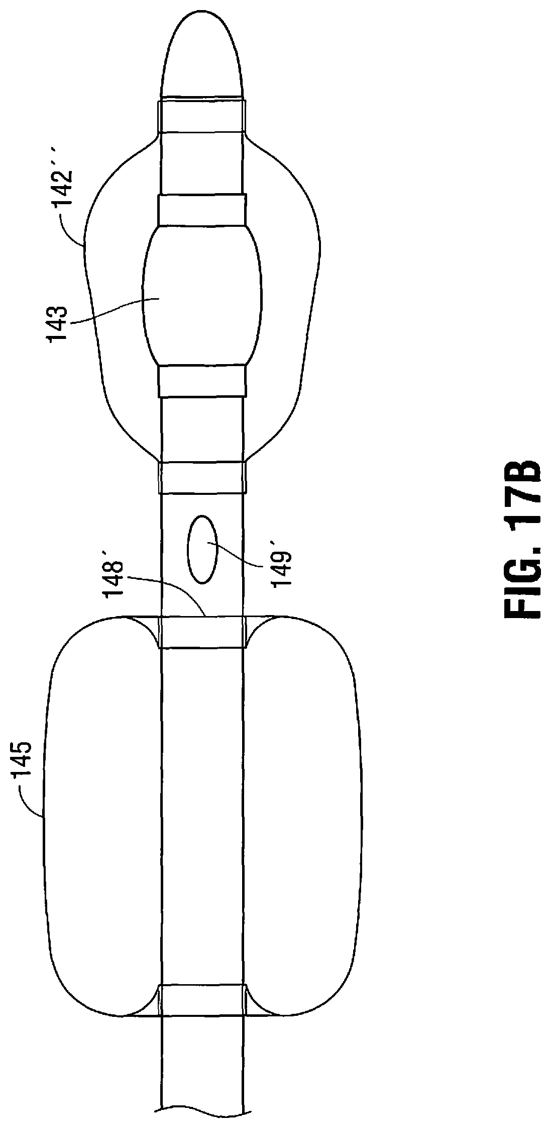 Patent US11779263 Figure 13 – Catheter for monitoring intra-abdominal pressure for assessing preeclampsia