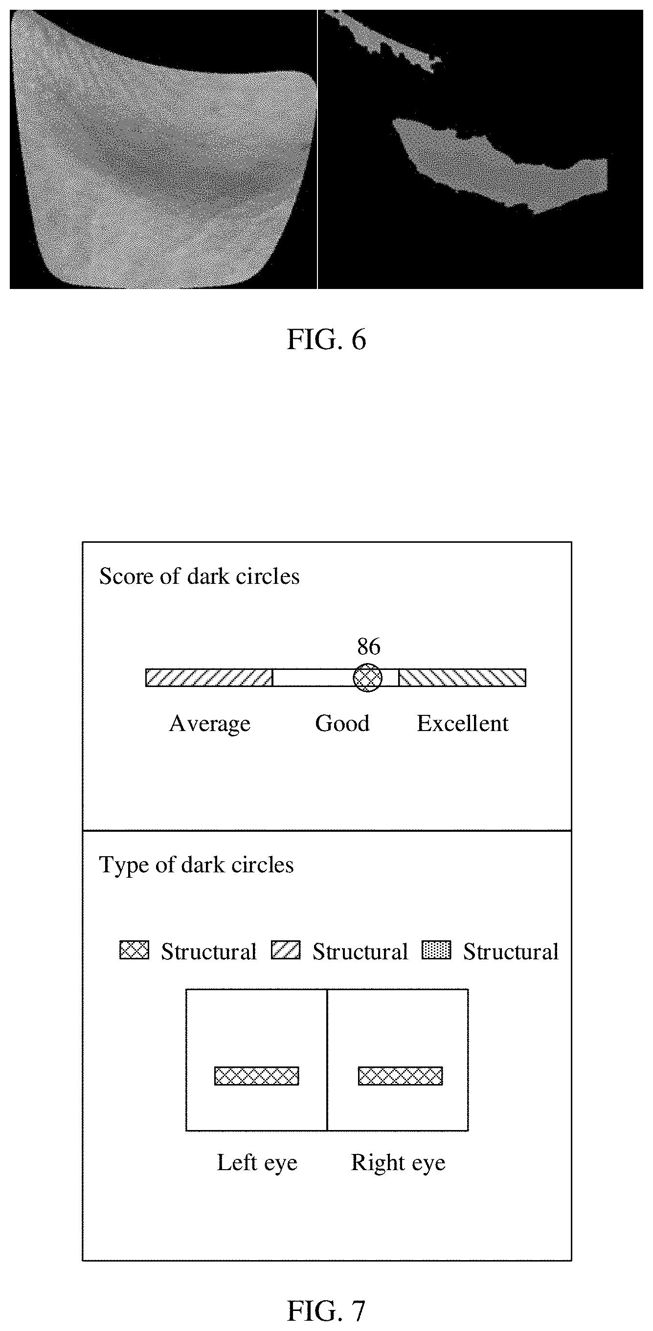 Patent US11779264 Figure 4 – Dark circle detection and evaluation method and apparatus