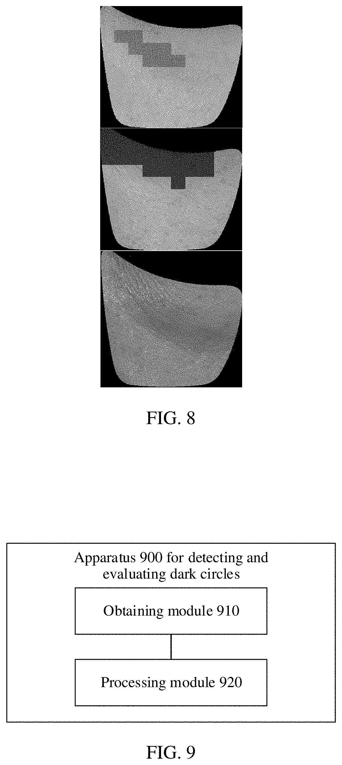Patent US11779264 Figure 5 – Dark circle detection and evaluation method and apparatus