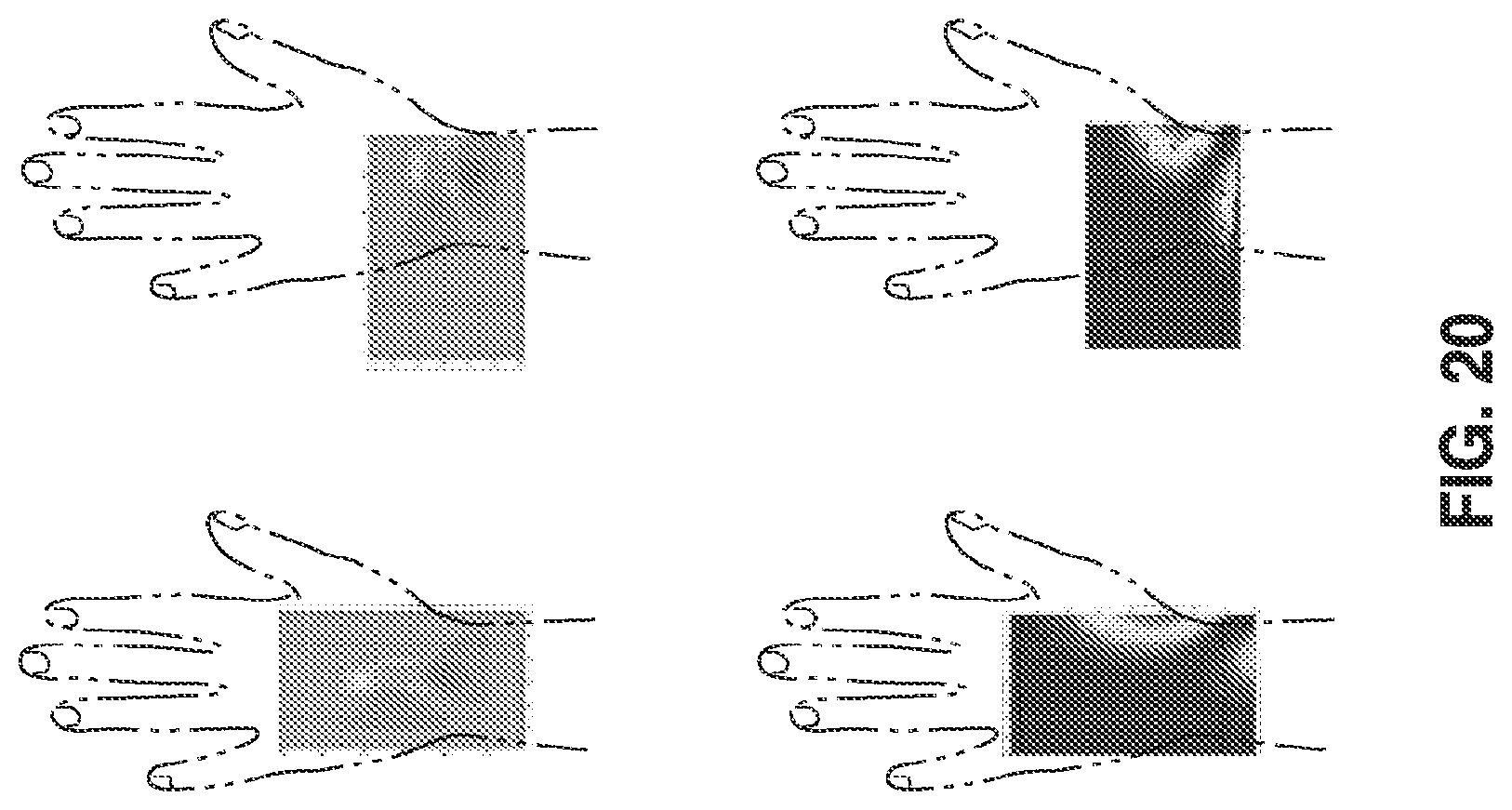 Patent US11779265 Figure 18 – SEM scanner sensing apparatus, system and methodology for early detection of ulcers