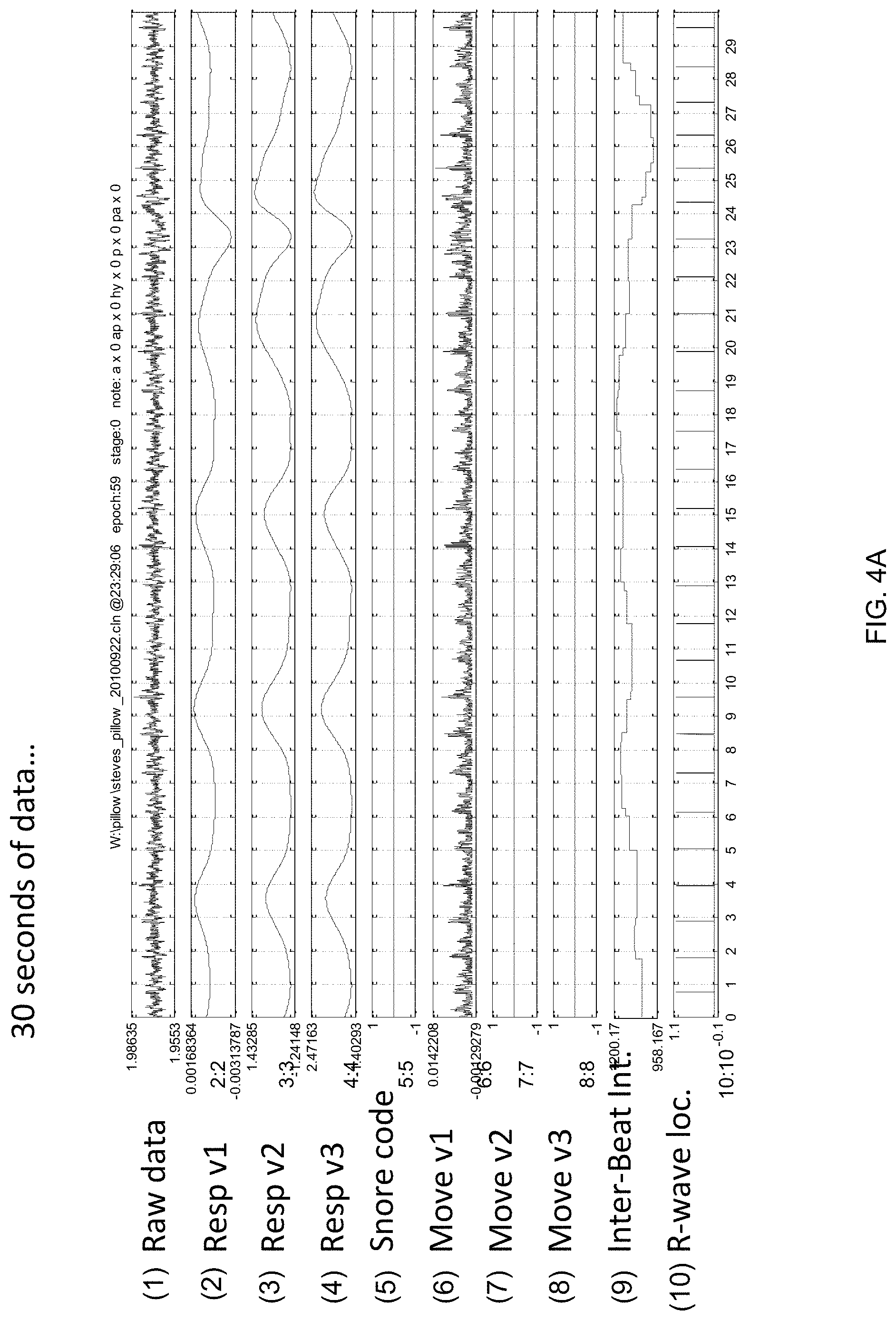 Patent US11779266 Figure 3 – Portable polysomnography apparatus and system