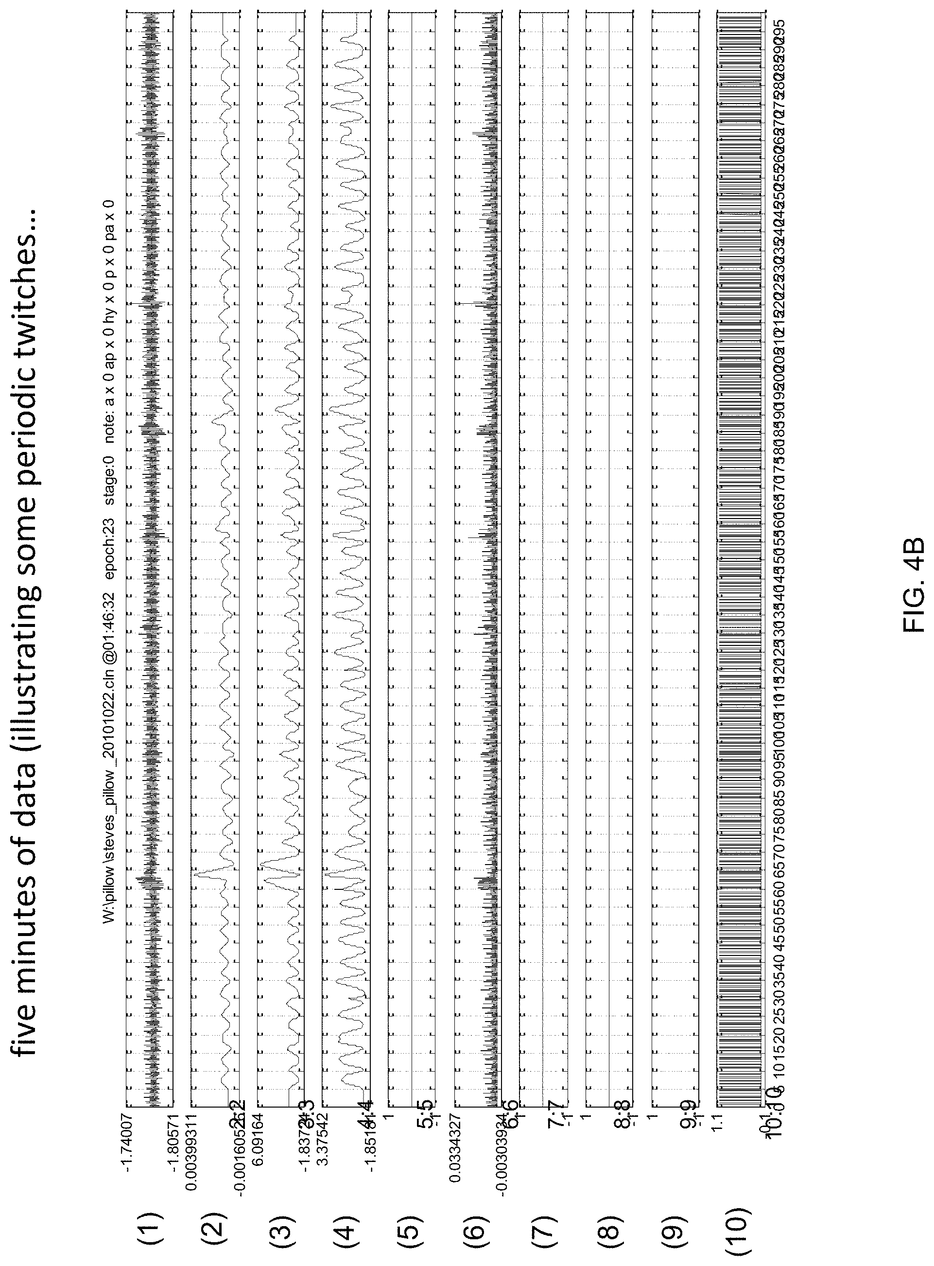 Patent US11779266 Figure 4 – Portable polysomnography apparatus and system