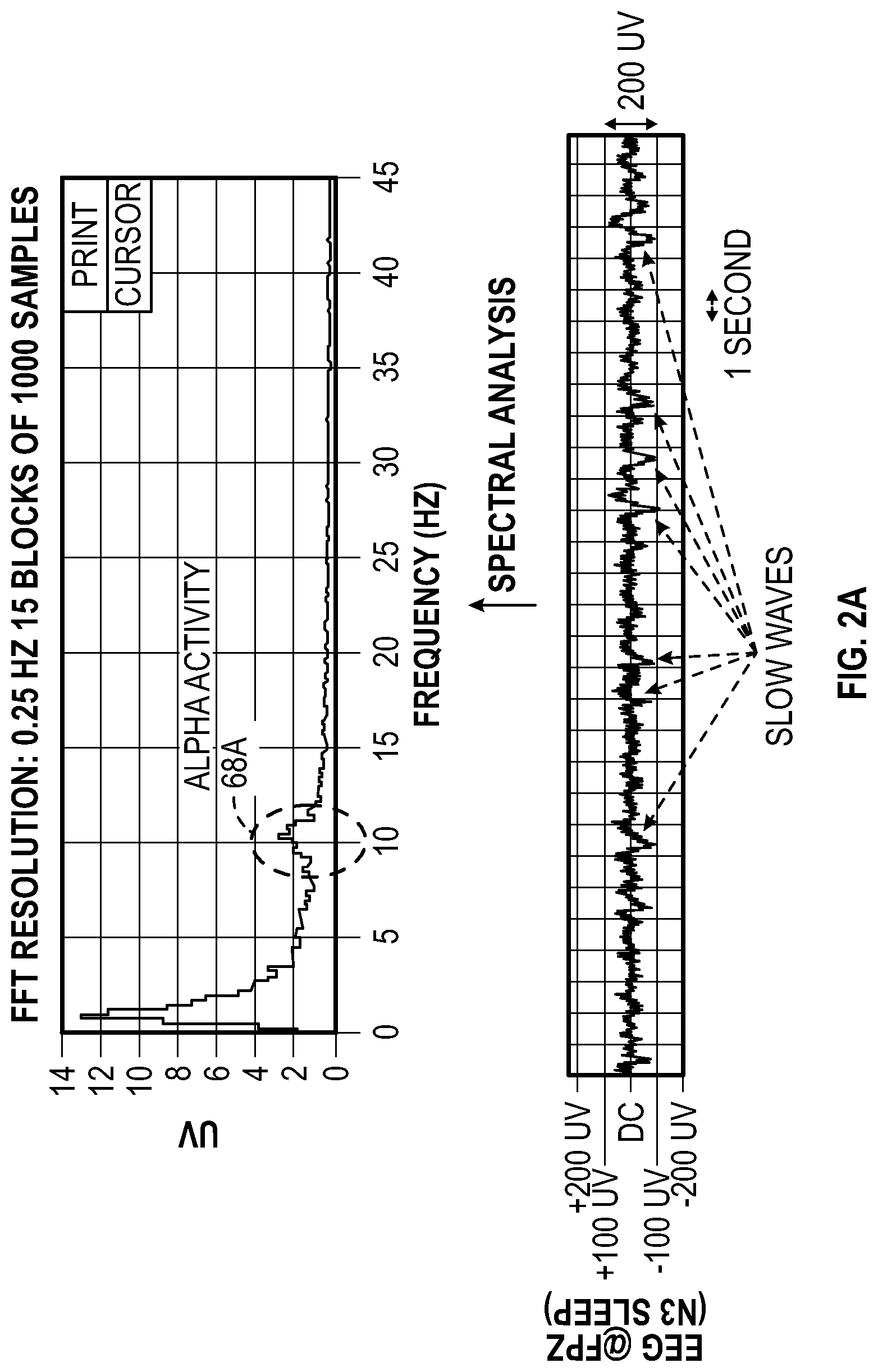 Patent US11779267 Figure 2 – Macro/micro-structure of sleep and similar states of consciousness to optimize pain treatment