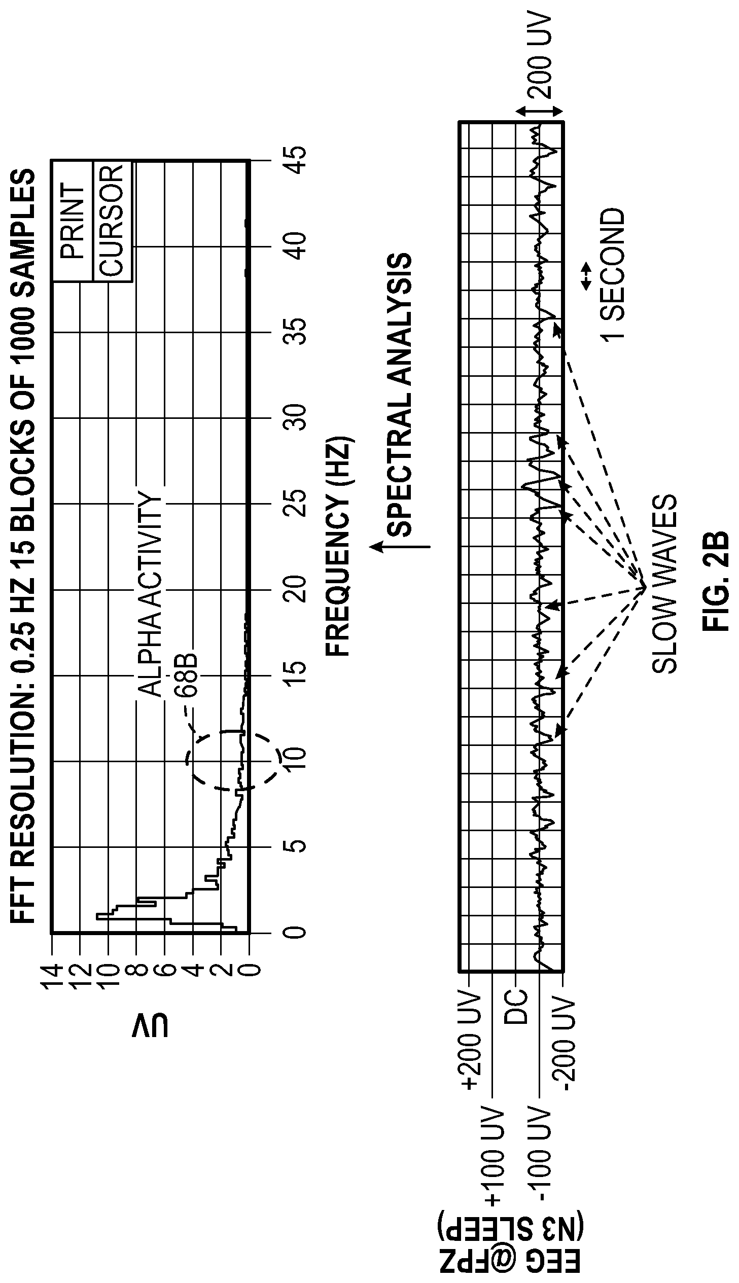 Patent US11779267 Figure 3 – Macro/micro-structure of sleep and similar states of consciousness to optimize pain treatment