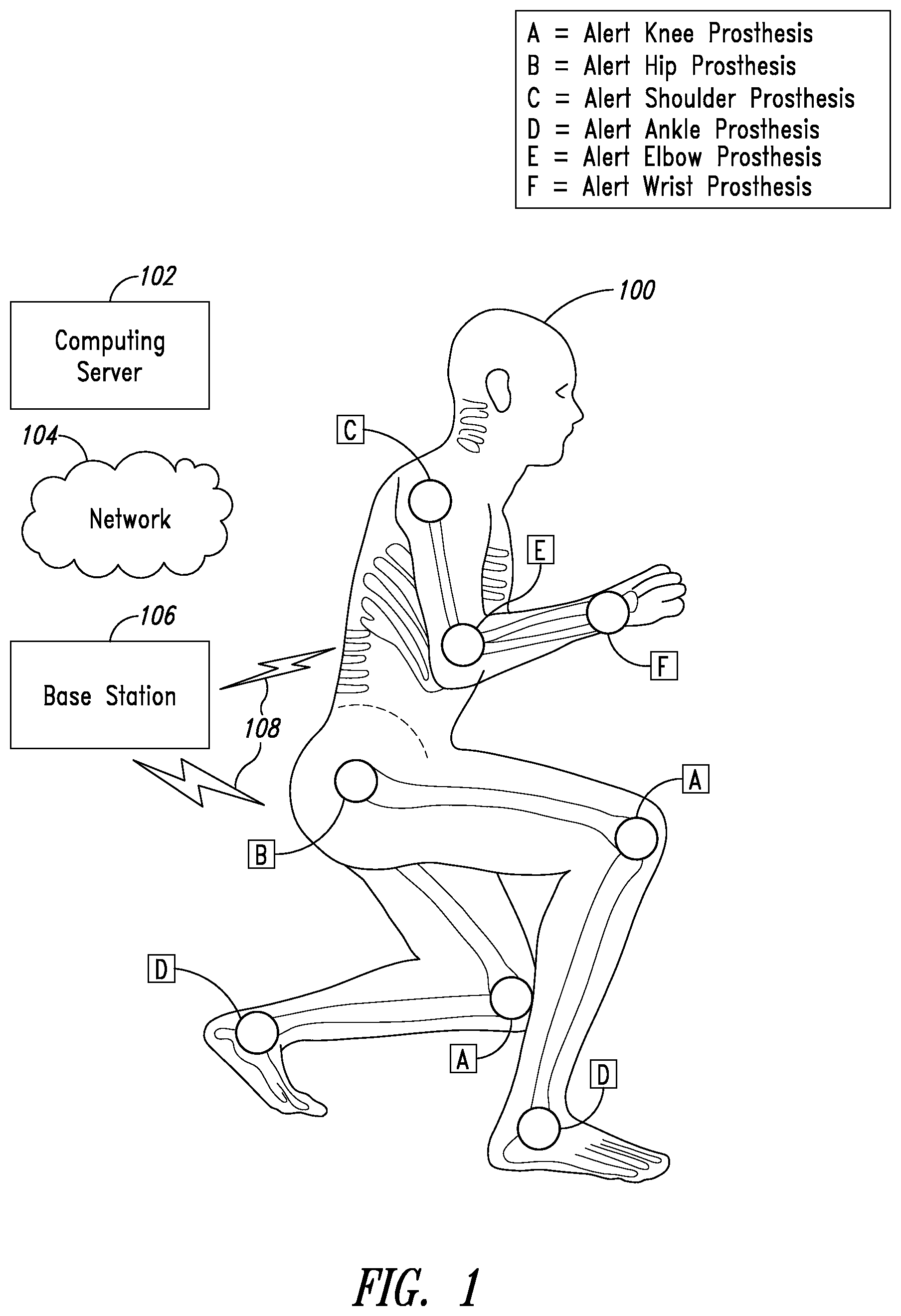 Patent US11779273 Figure 1 – Implantable reporting processor for an alert implant