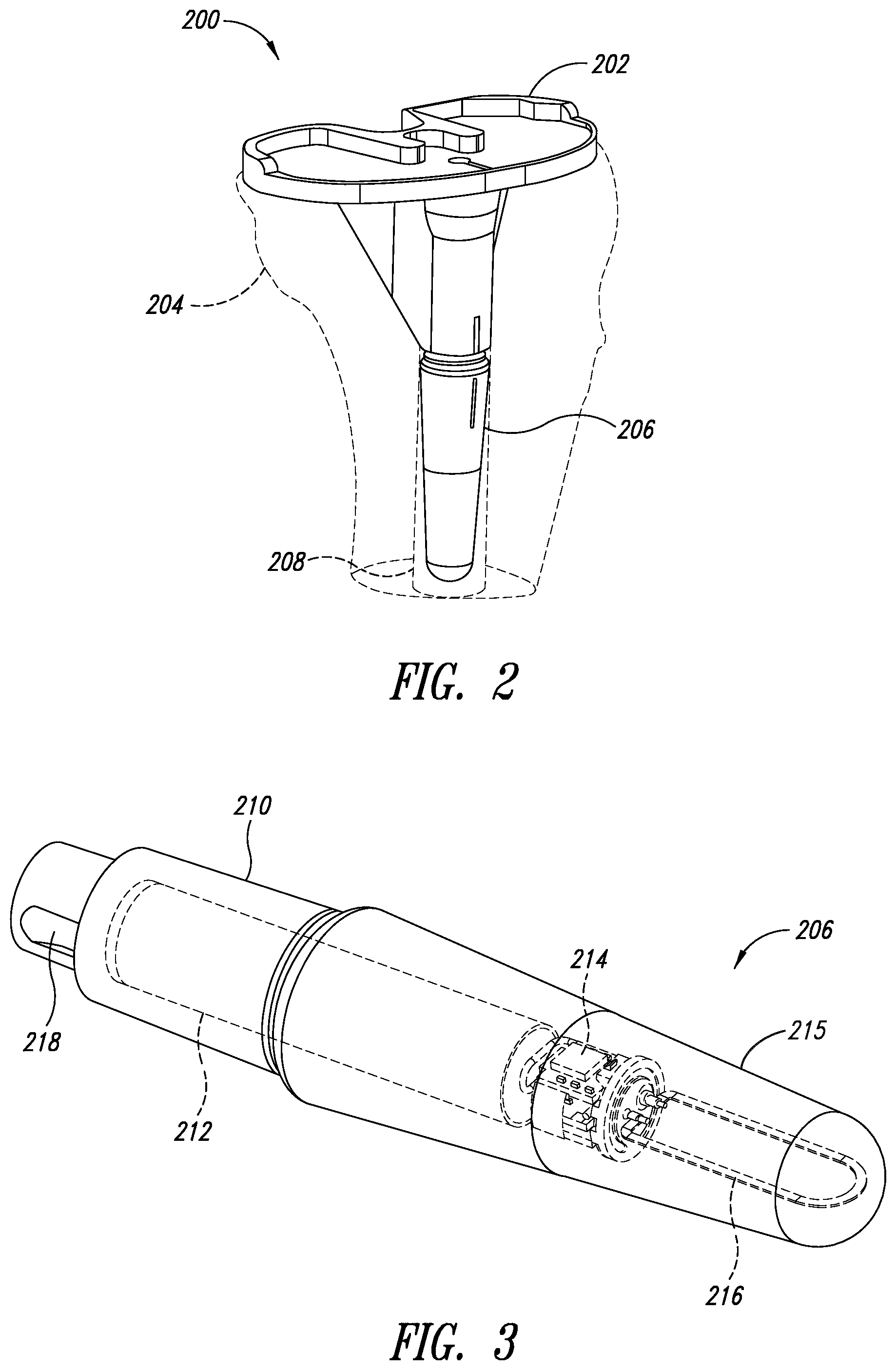 Patent US11779273 Figure 2 – Implantable reporting processor for an alert implant