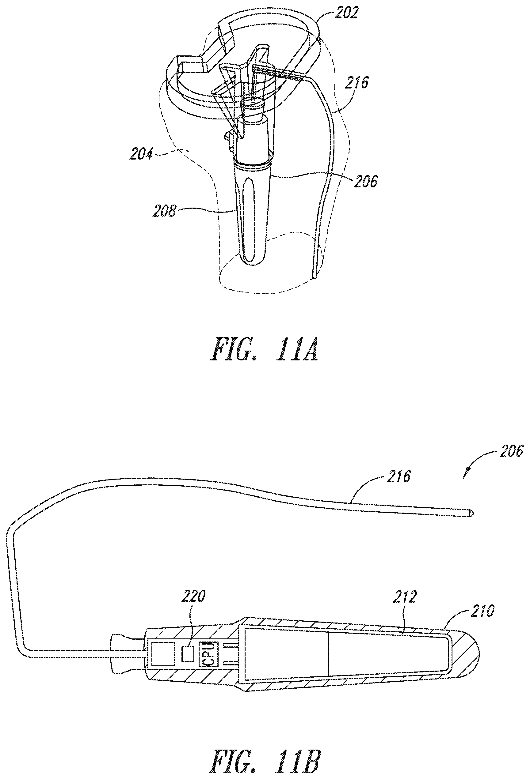 Patent US11779273 Figure 10 – Implantable reporting processor for an alert implant