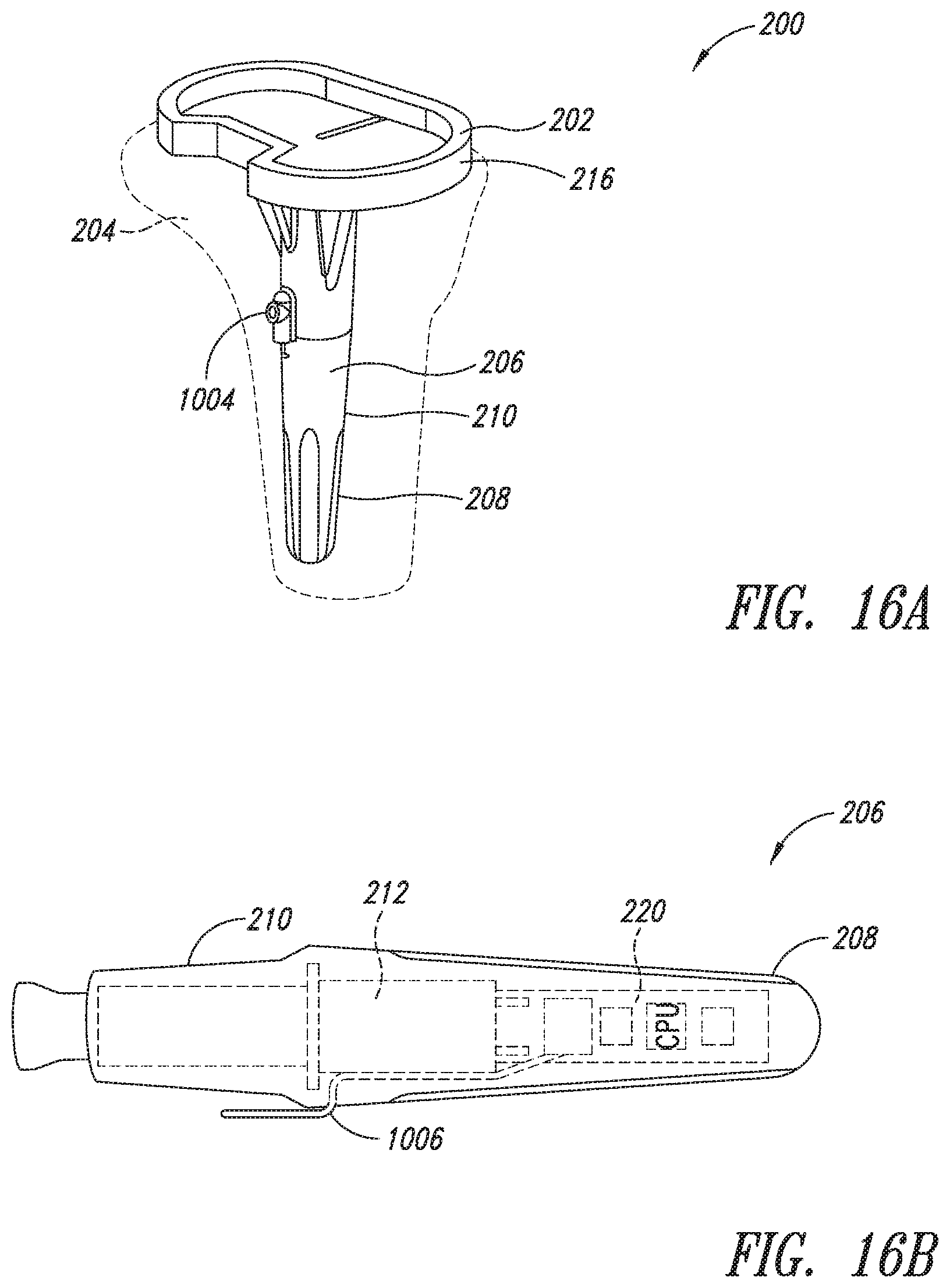 Patent US11779273 Figure 15 – Implantable reporting processor for an alert implant