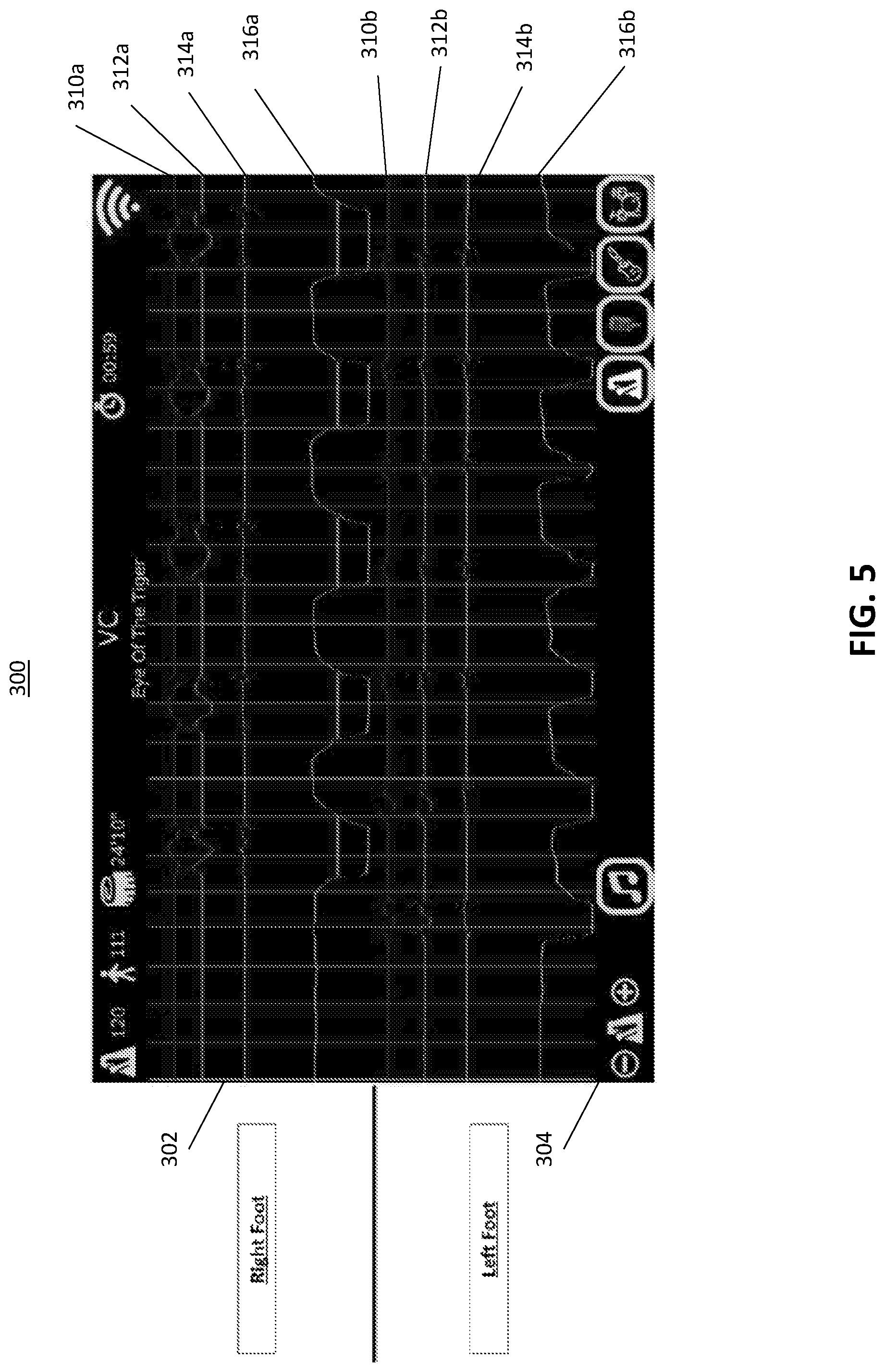 Patent US11779274 Figure 5 – Systems and methods for neurologic rehabilitation