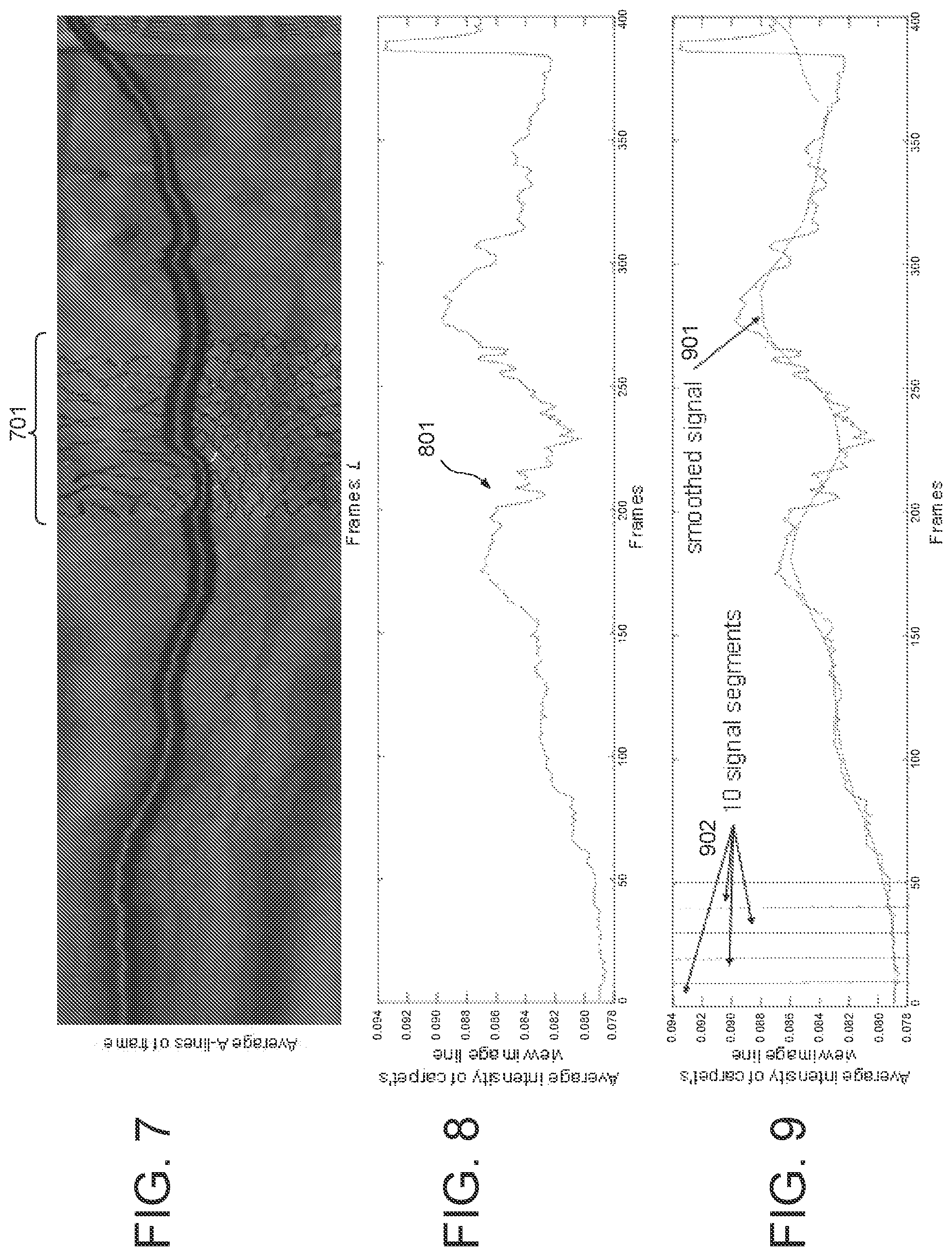 Patent US11779277 Figure 5 – Systems and methods for endovascular device detection and apposition measurement