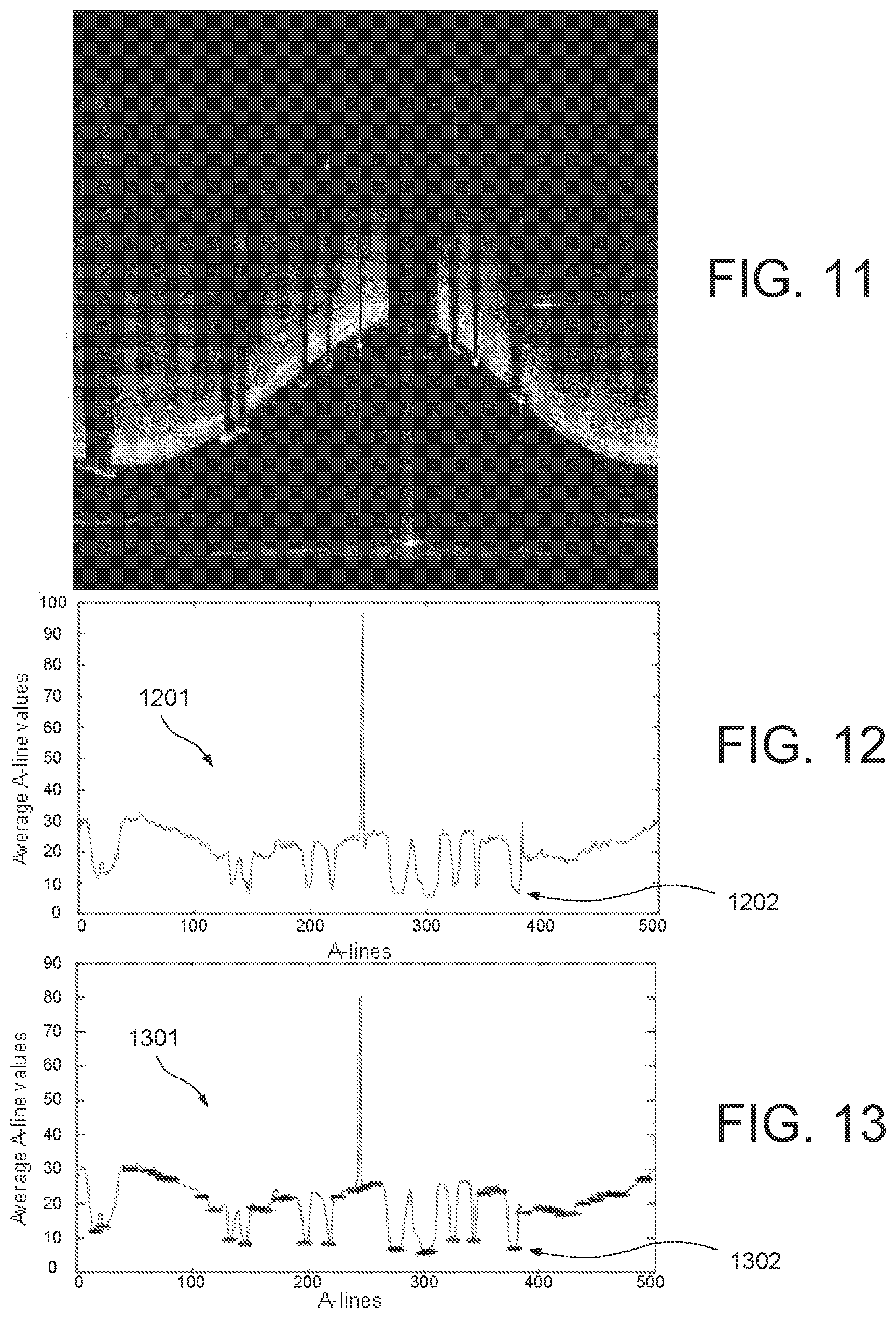 Patent US11779277 Figure 7 – Systems and methods for endovascular device detection and apposition measurement