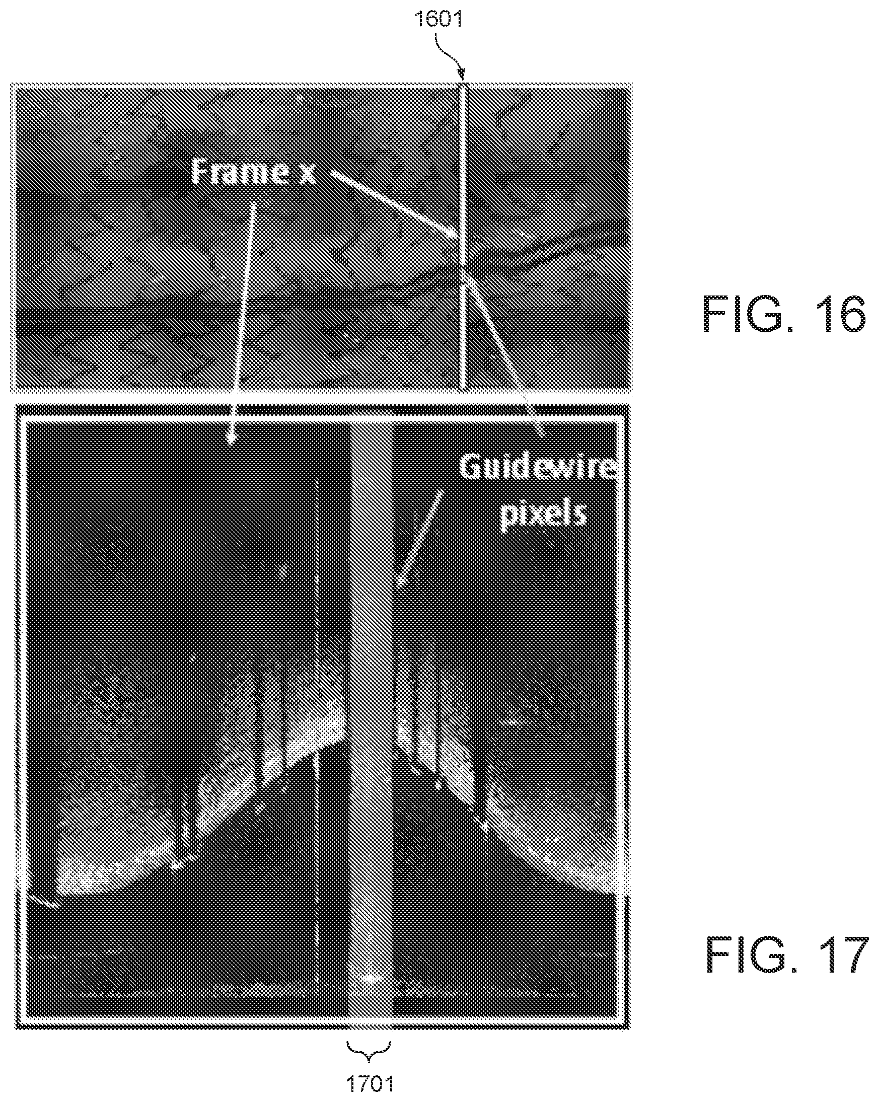 Patent US11779277 Figure 10 – Systems and methods for endovascular device detection and apposition measurement