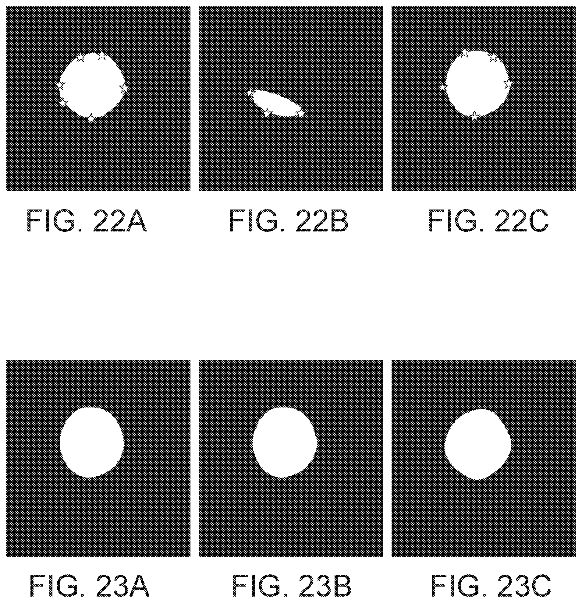 Patent US11779277 Figure 13 – Systems and methods for endovascular device detection and apposition measurement