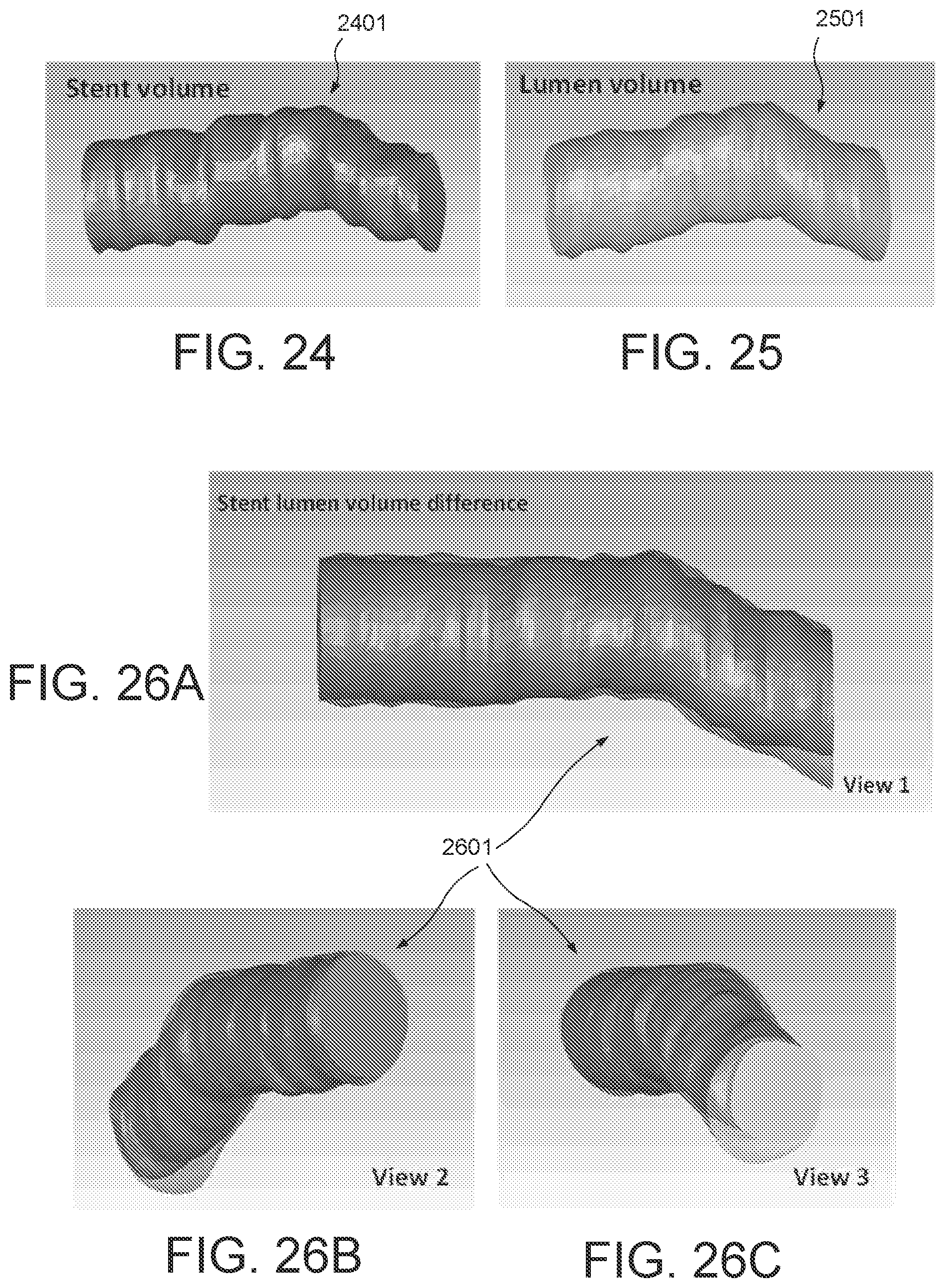Patent US11779277 Figure 14 – Systems and methods for endovascular device detection and apposition measurement