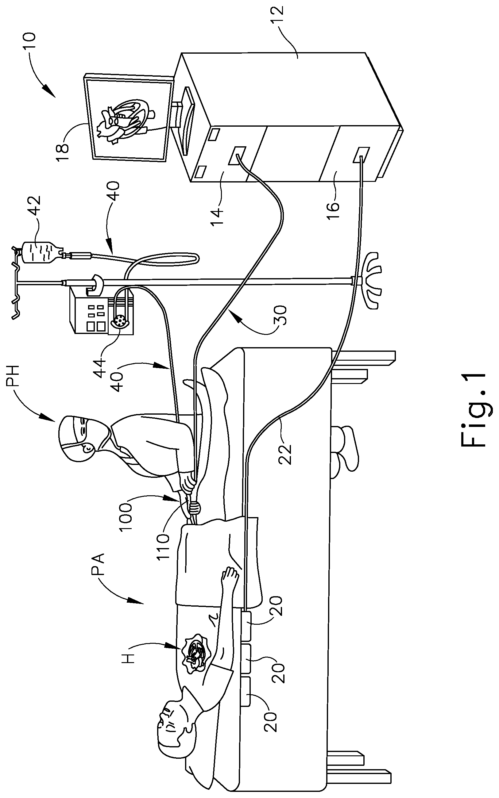 Patent US11779280 Figure 1 – Reference wires to remove noise and artifacts in cardiac mapping catheter