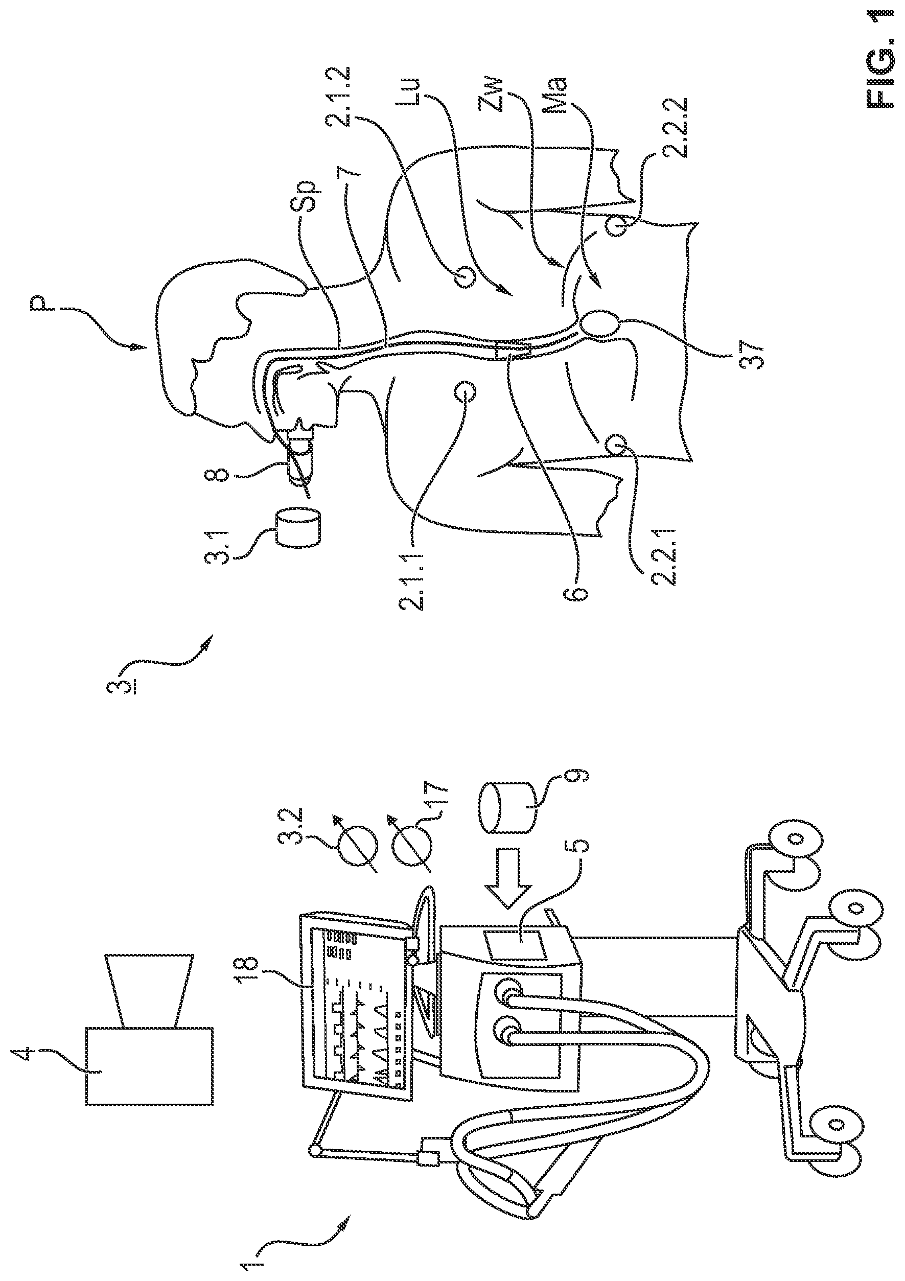 Patent US11779283 — Process and signal processing unit for determining a cardiogenic signal — Figure 1