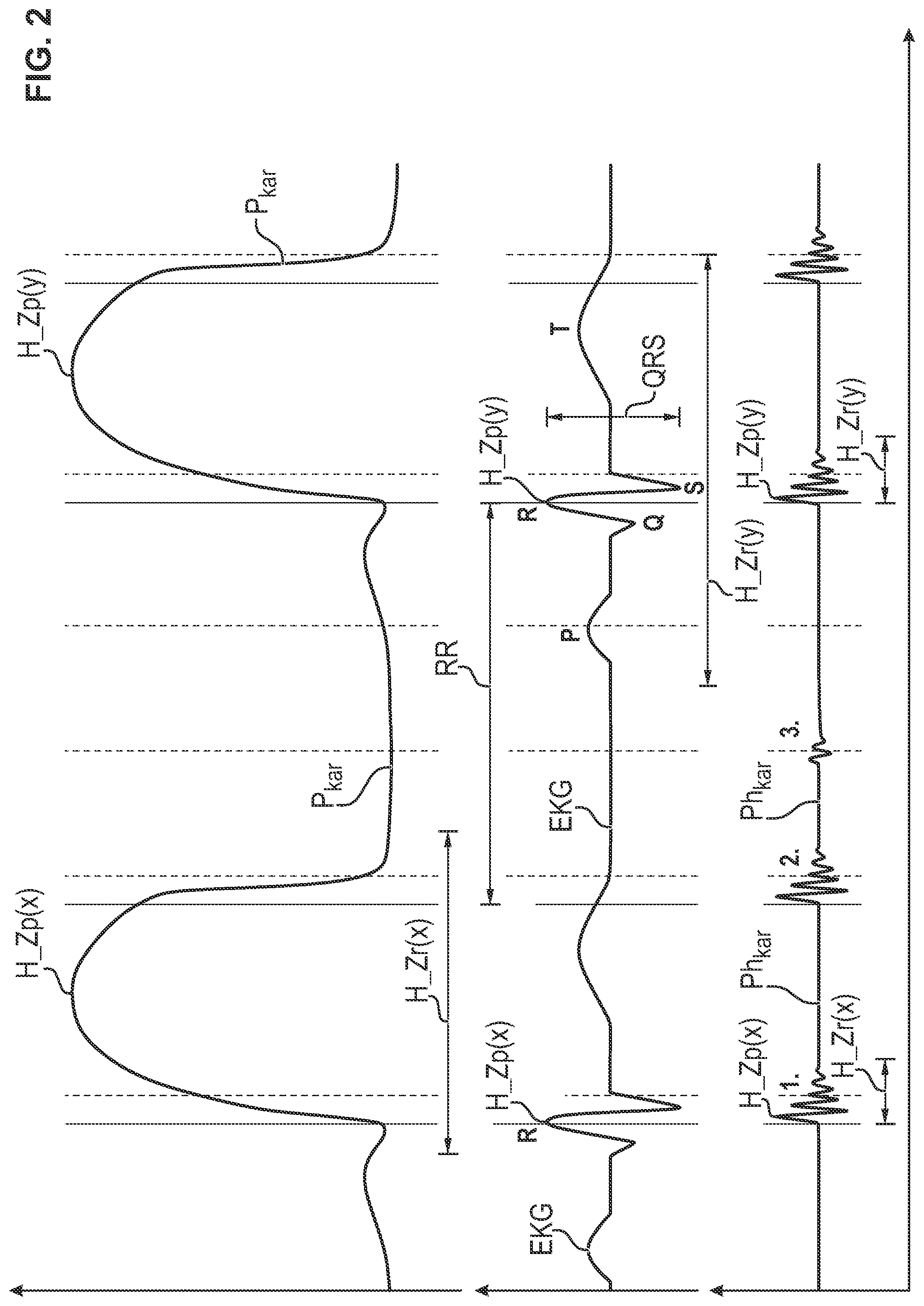 Patent US11779283 Figure 2 – Process and signal processing unit for determining a cardiogenic signal