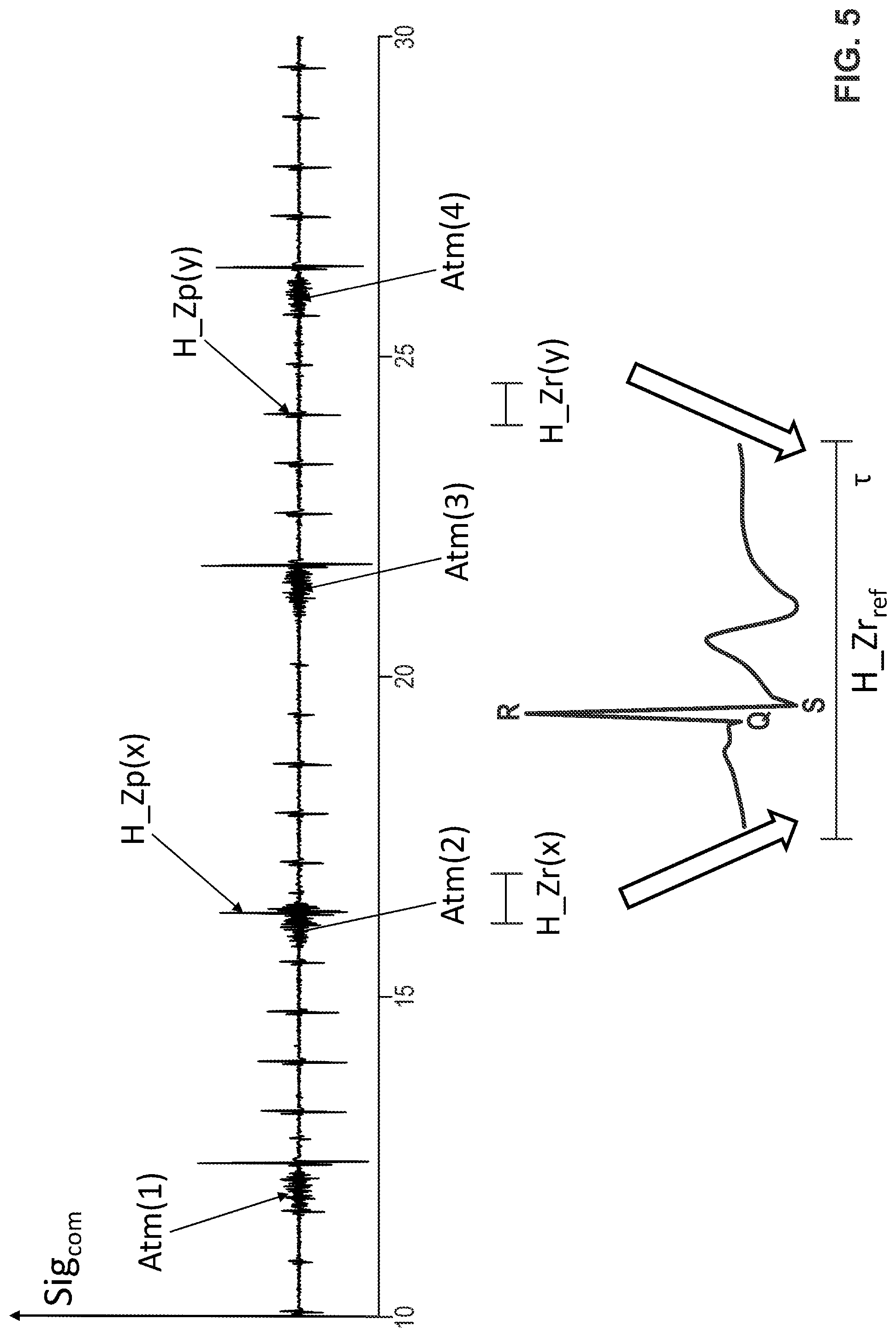 Patent US11779283 Figure 5 – Process and signal processing unit for determining a cardiogenic signal