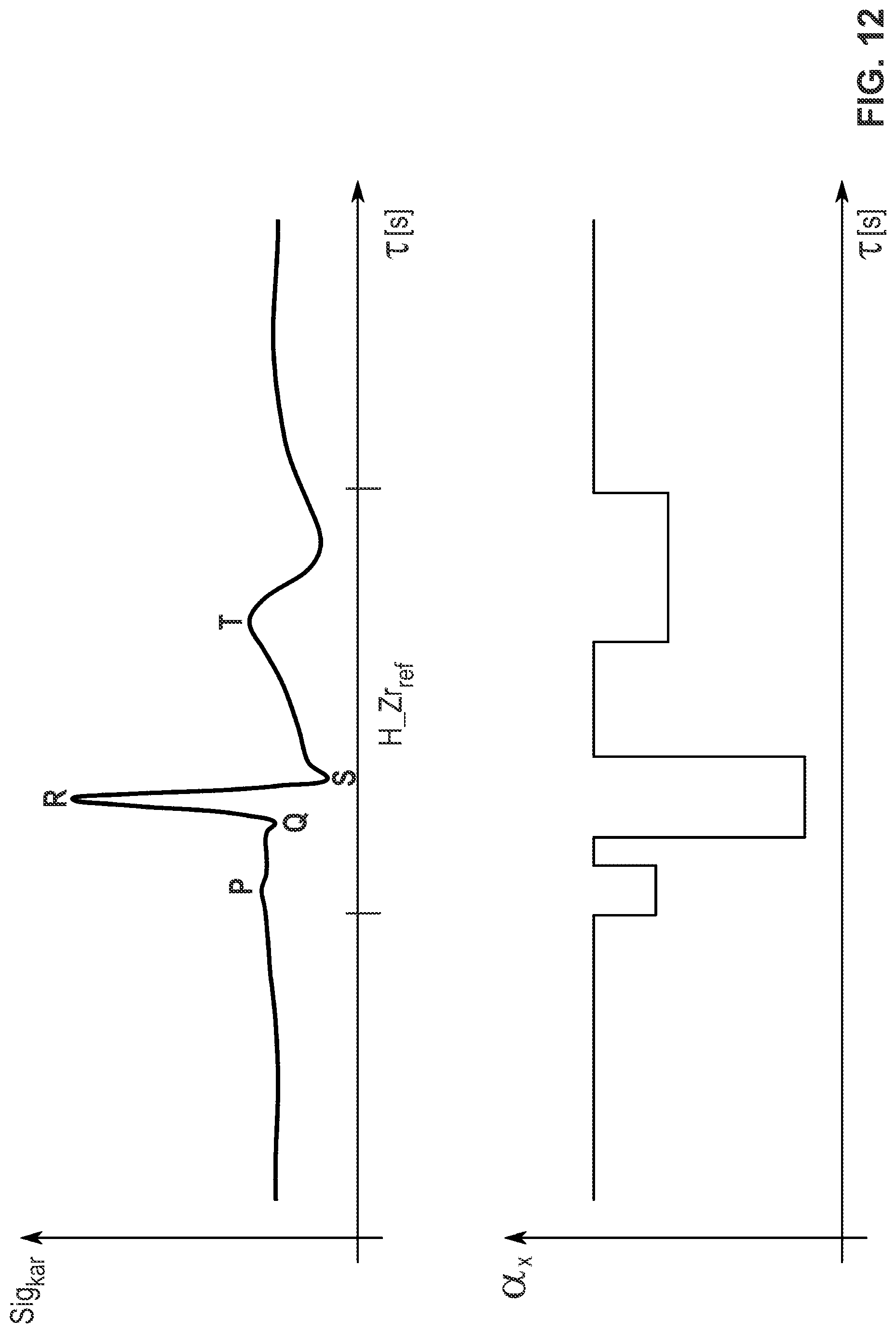 Patent US11779283 Figure 12 – Process and signal processing unit for determining a cardiogenic signal