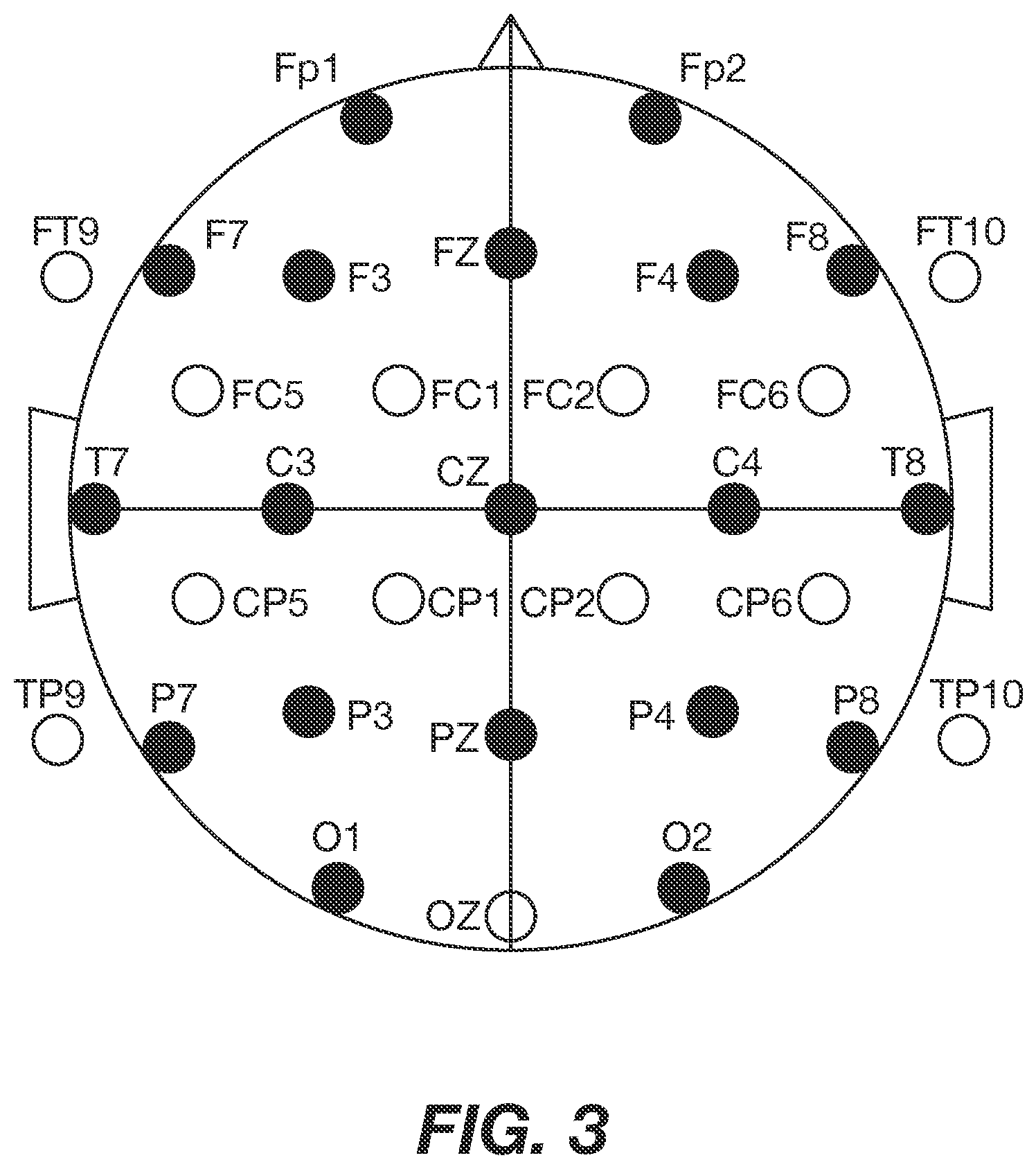 Patent US11779285 Figure 3 – Electrically conductive eartips