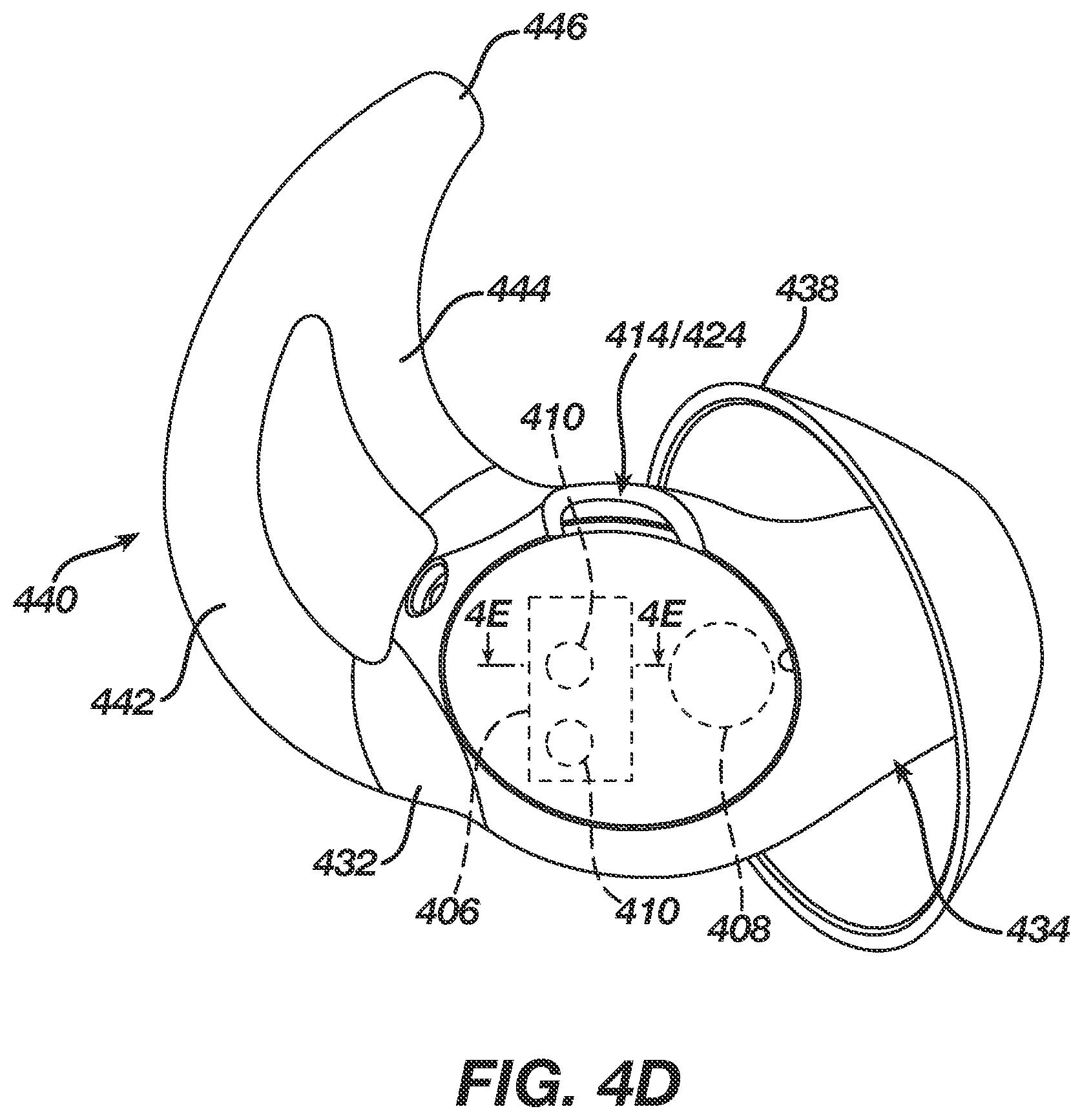 Patent US11779285 Figure 7 – Electrically conductive eartips