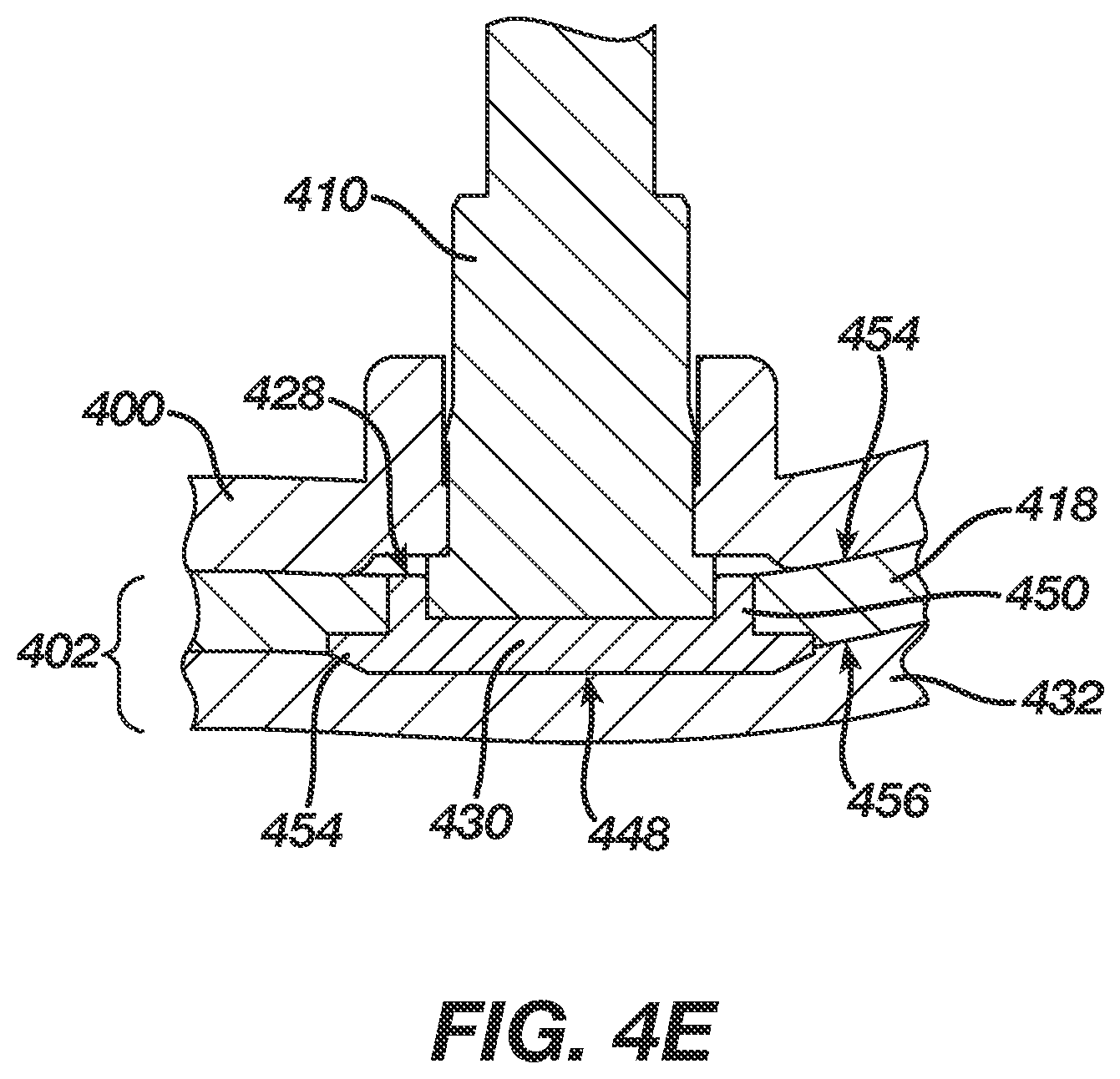Patent US11779285 Figure 8 – Electrically conductive eartips