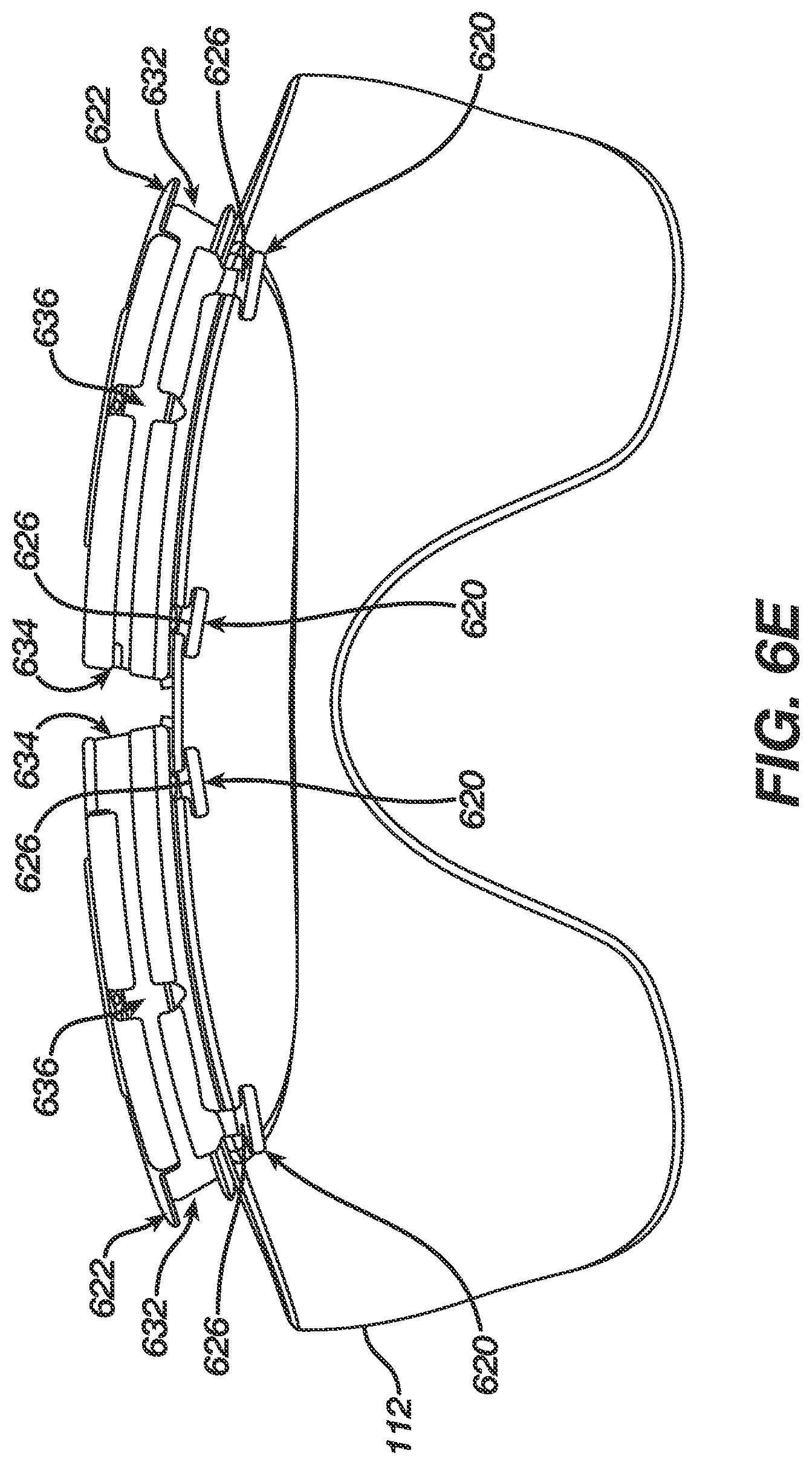 Patent US11779285 Figure 14 – Electrically conductive eartips