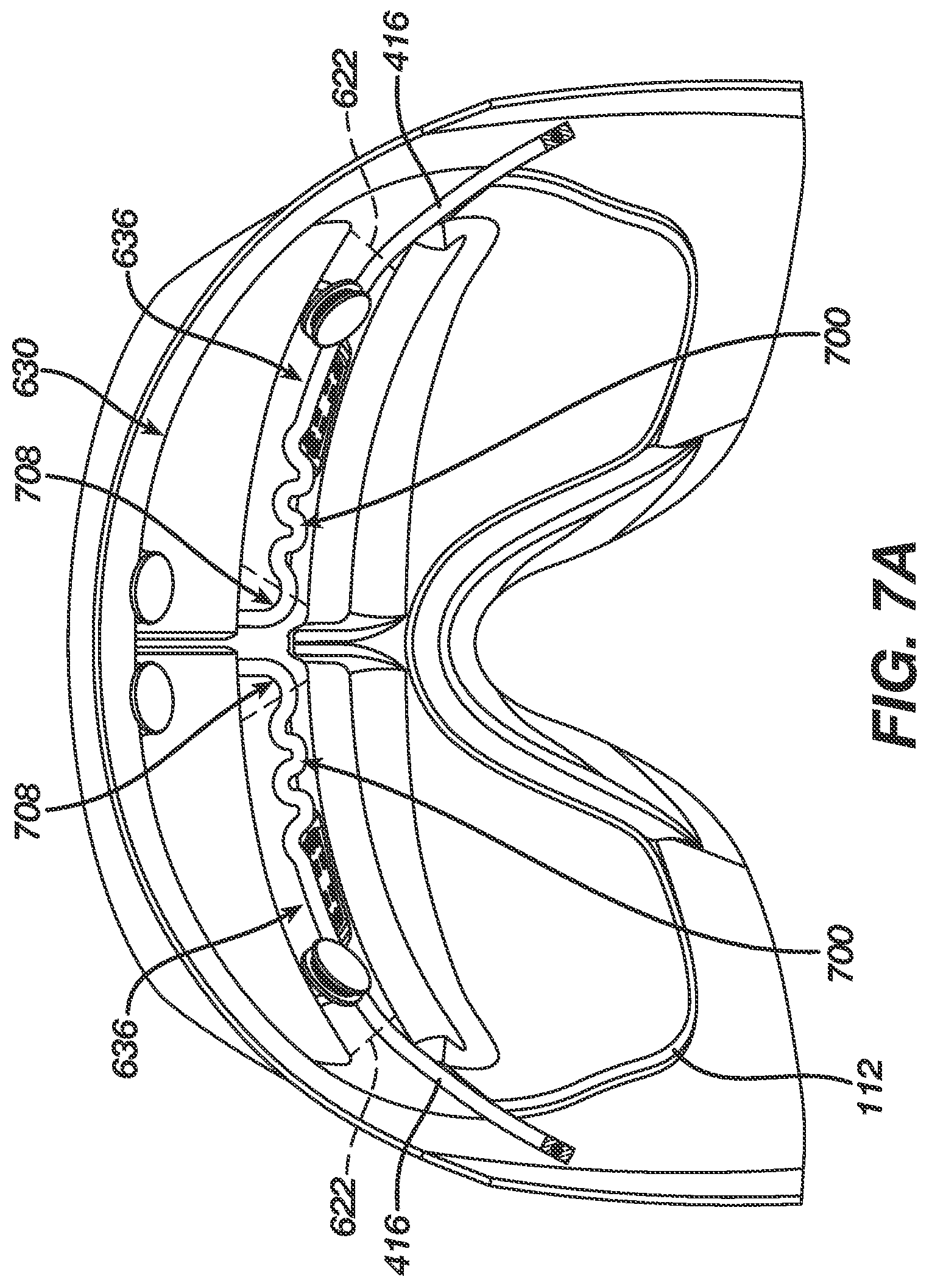Patent US11779285 Figure 15 – Electrically conductive eartips