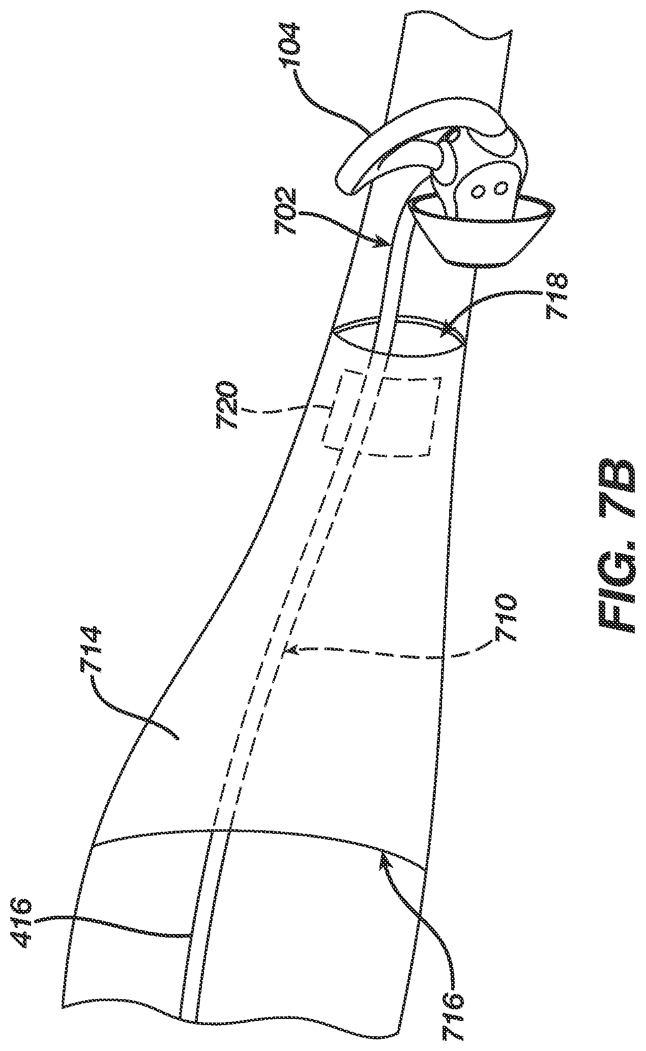 Patent US11779285 Figure 16 – Electrically conductive eartips