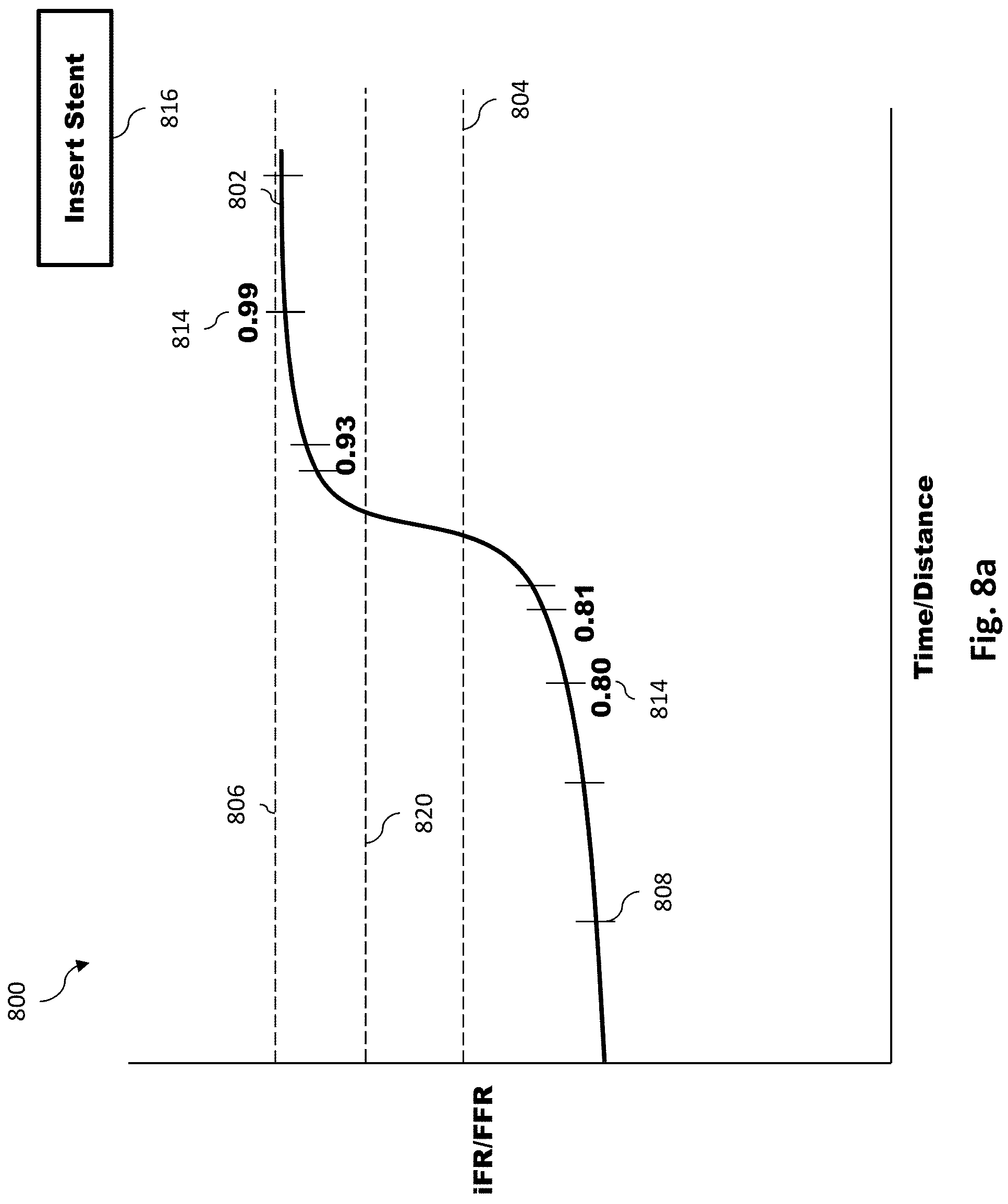 Patent US11779286 Figure 8 – Percutaneous coronary intervention (PCI) planning interface with pressure data and vessel data and associated devices, systems, and methods
