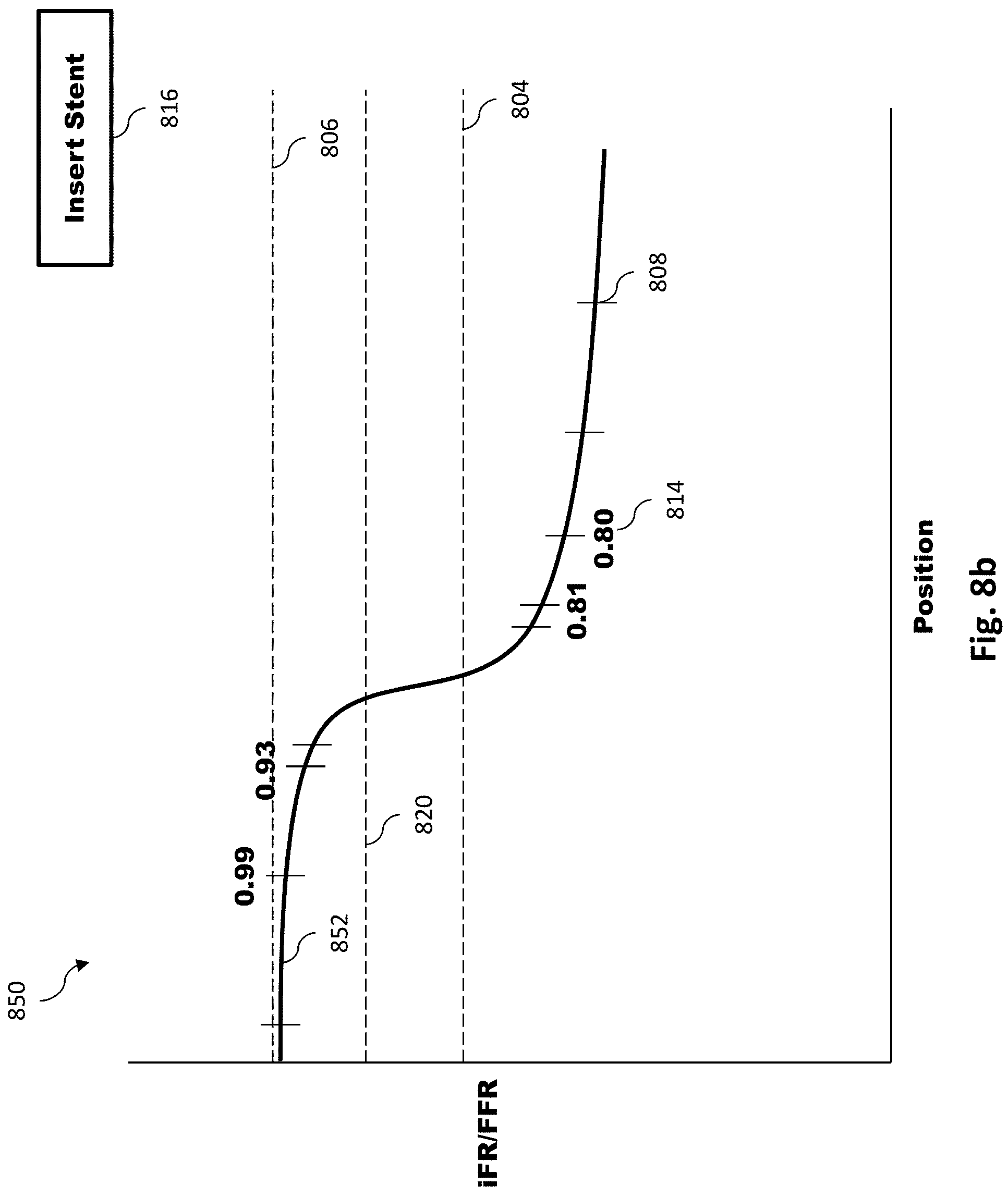 Patent US11779286 Figure 9 – Percutaneous coronary intervention (PCI) planning interface with pressure data and vessel data and associated devices, systems, and methods