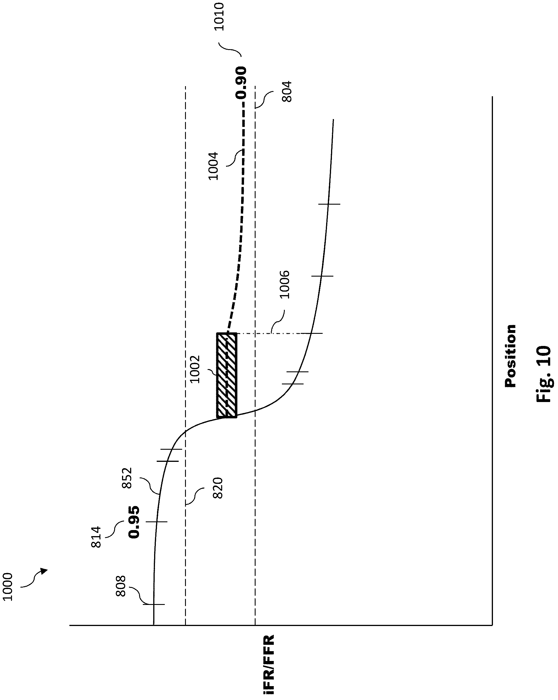 Patent US11779286 Figure 11 – Percutaneous coronary intervention (PCI) planning interface with pressure data and vessel data and associated devices, systems, and methods
