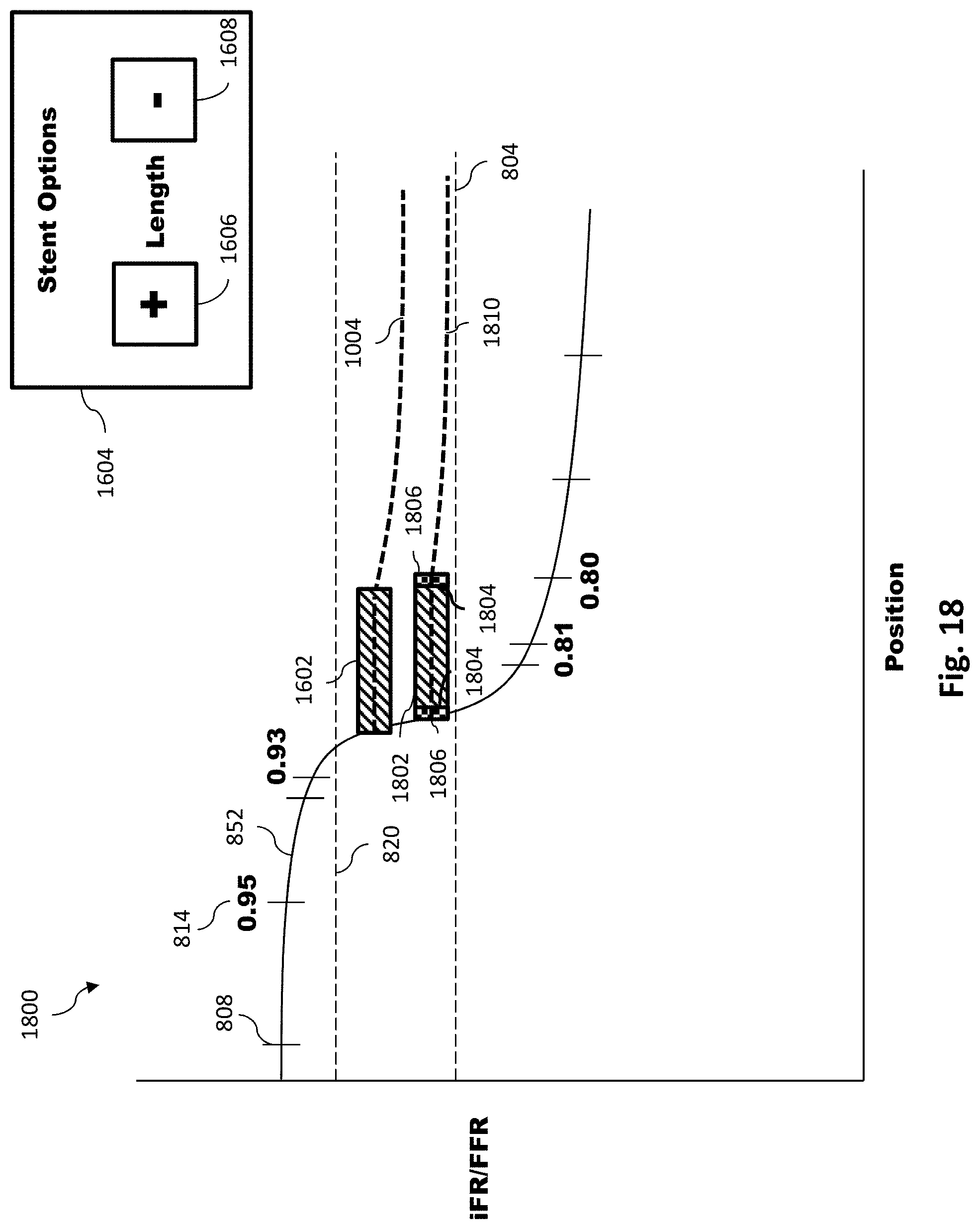 Patent US11779286 Figure 19 – Percutaneous coronary intervention (PCI) planning interface with pressure data and vessel data and associated devices, systems, and methods