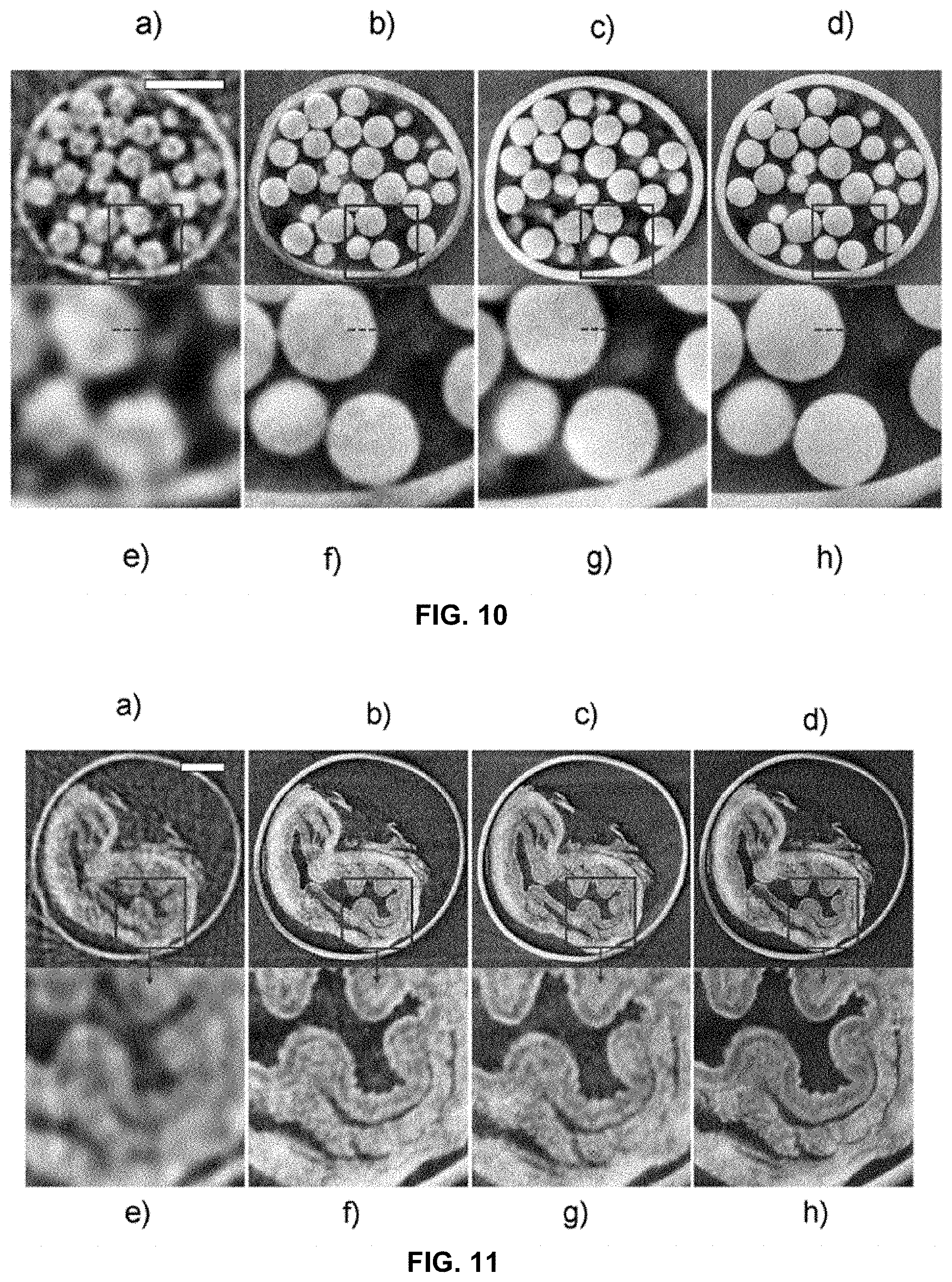 Patent US11779287 Figure 5 – Computed tomography imaging