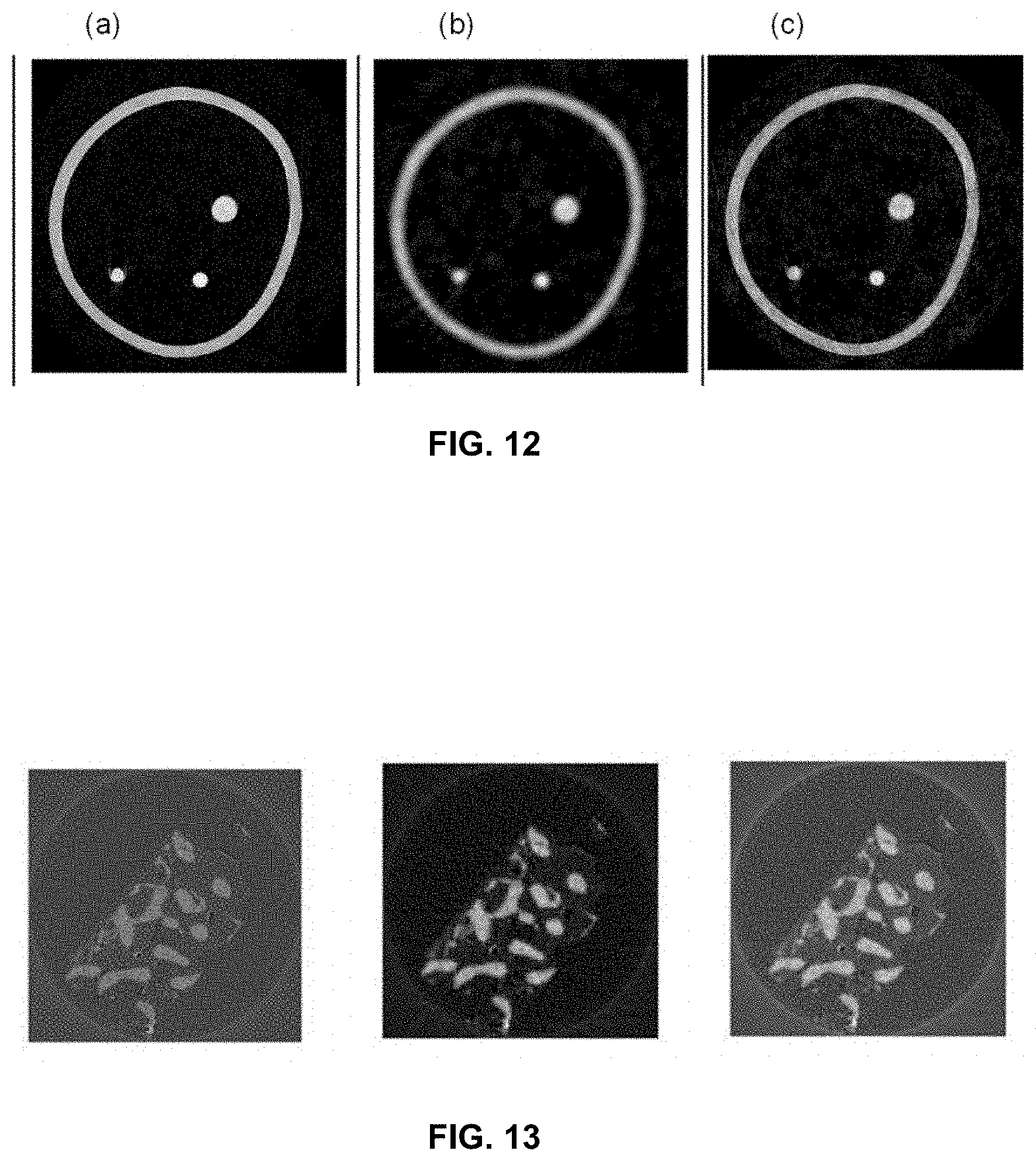 Patent US11779287 Figure 6 – Computed tomography imaging