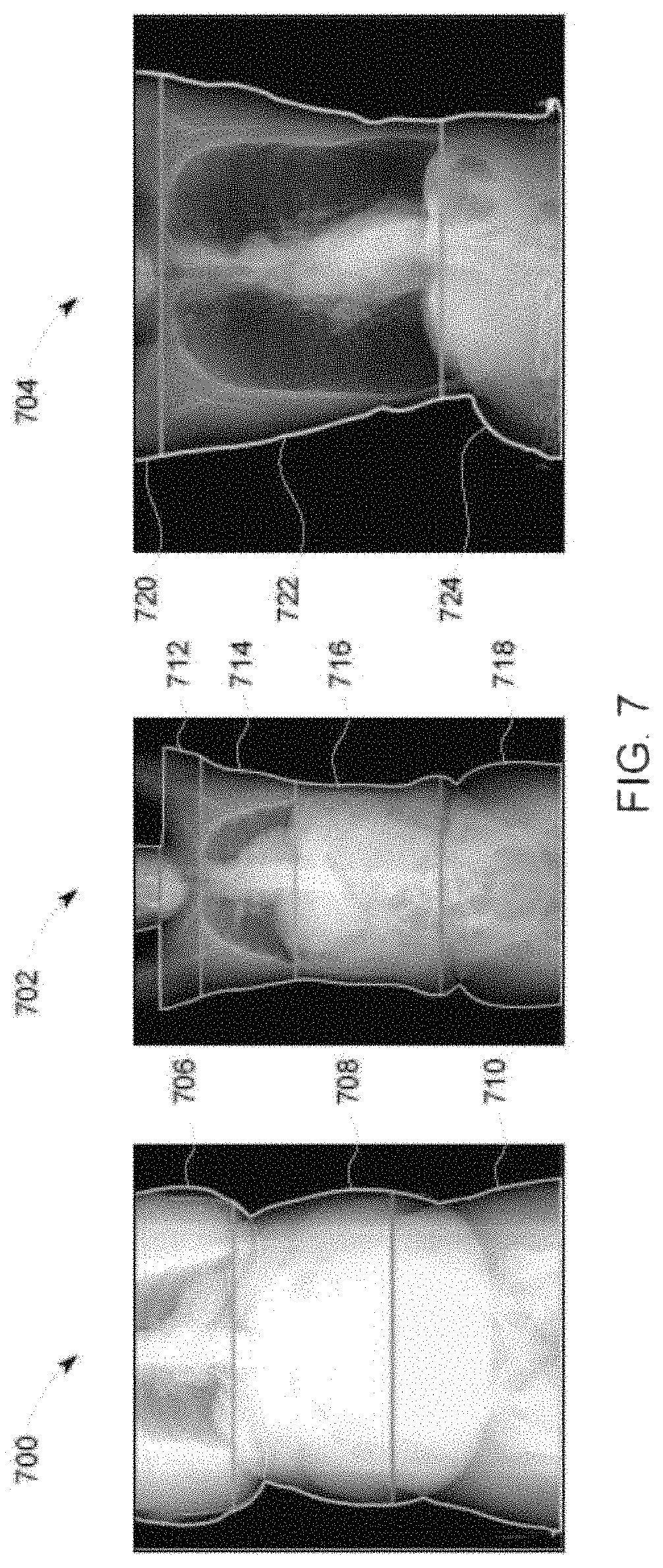 Patent US11779288 Figure 7 – Methods, systems, and apparatus for determining radiation doses