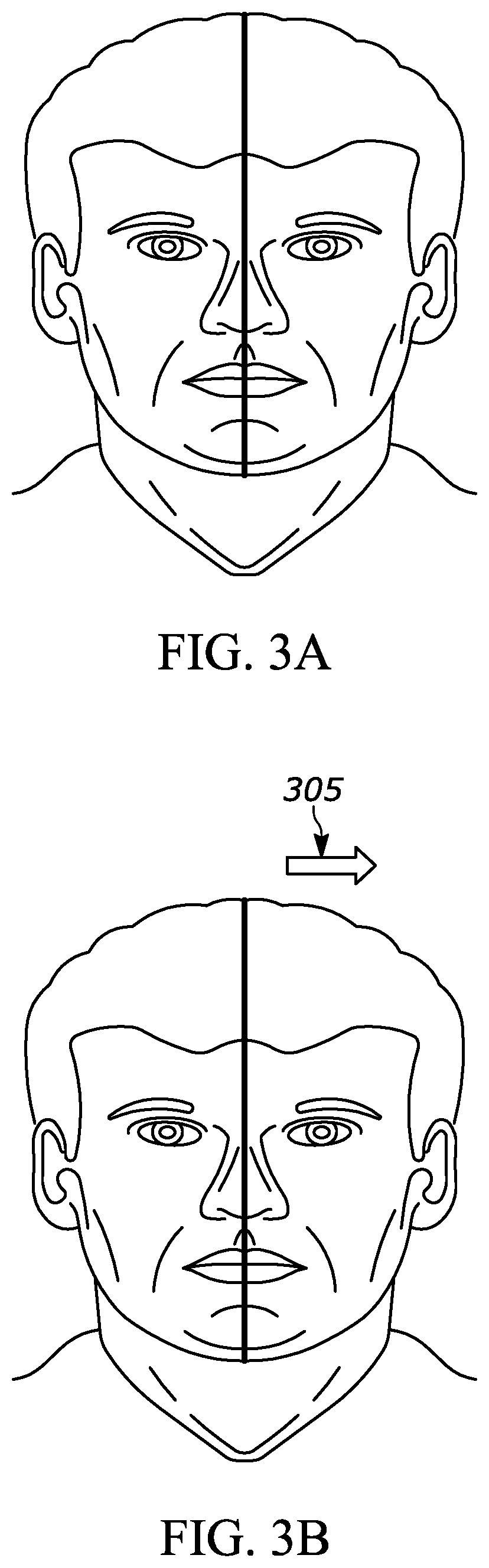 Patent US11779289 Figure 5 – Two-way mirror display for dental treatment system
