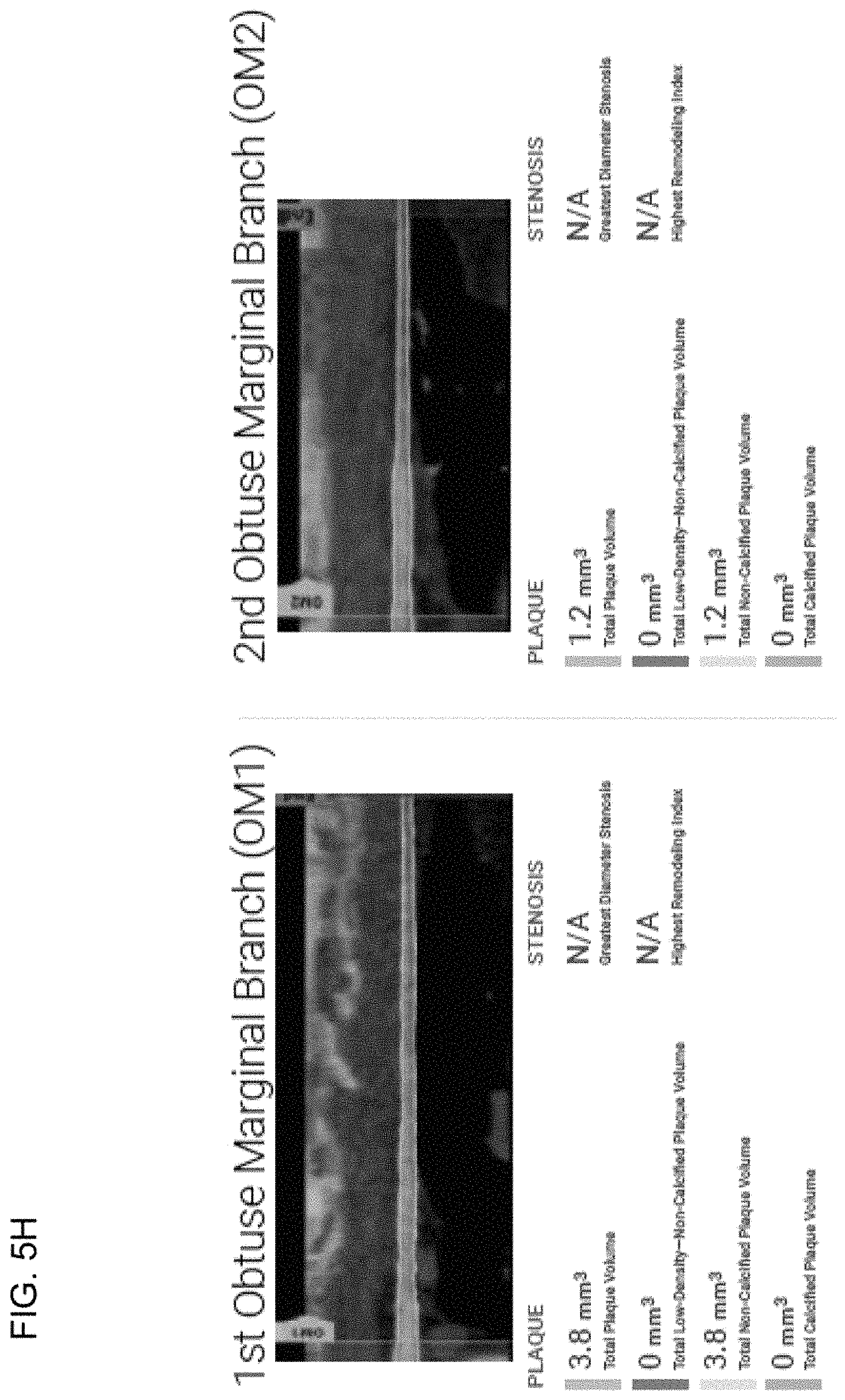 Patent US11779292 Figure 18 – Systems, methods, and devices for medical image analysis, diagnosis, risk stratification, decision making and/or disease tracking
