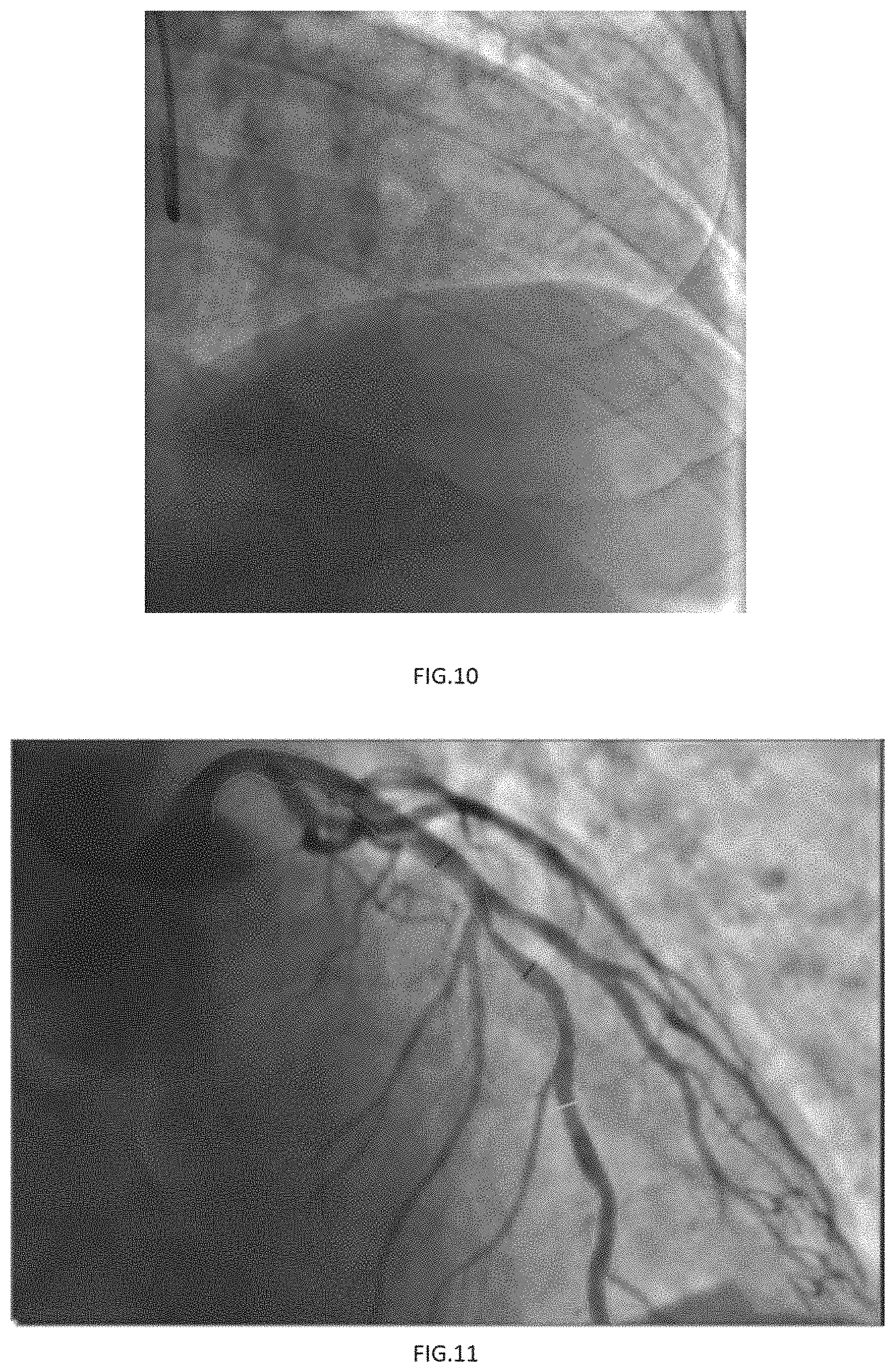 Patent US11779294 Figure 5 – Method, device and system for calculating microcirculation indicator based on image and pressure sensor