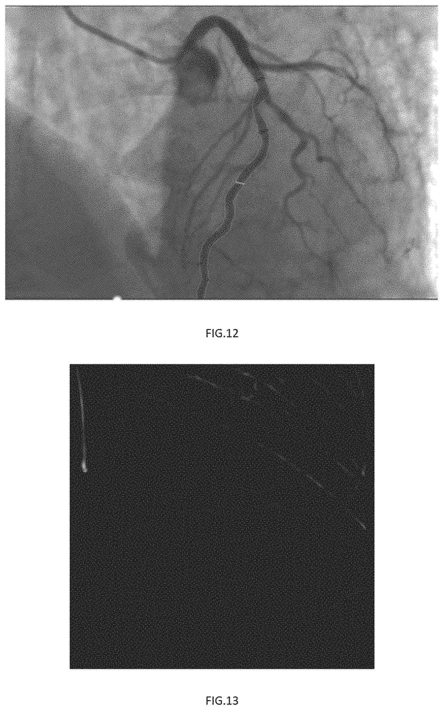 Patent US11779294 Figure 6 – Method, device and system for calculating microcirculation indicator based on image and pressure sensor