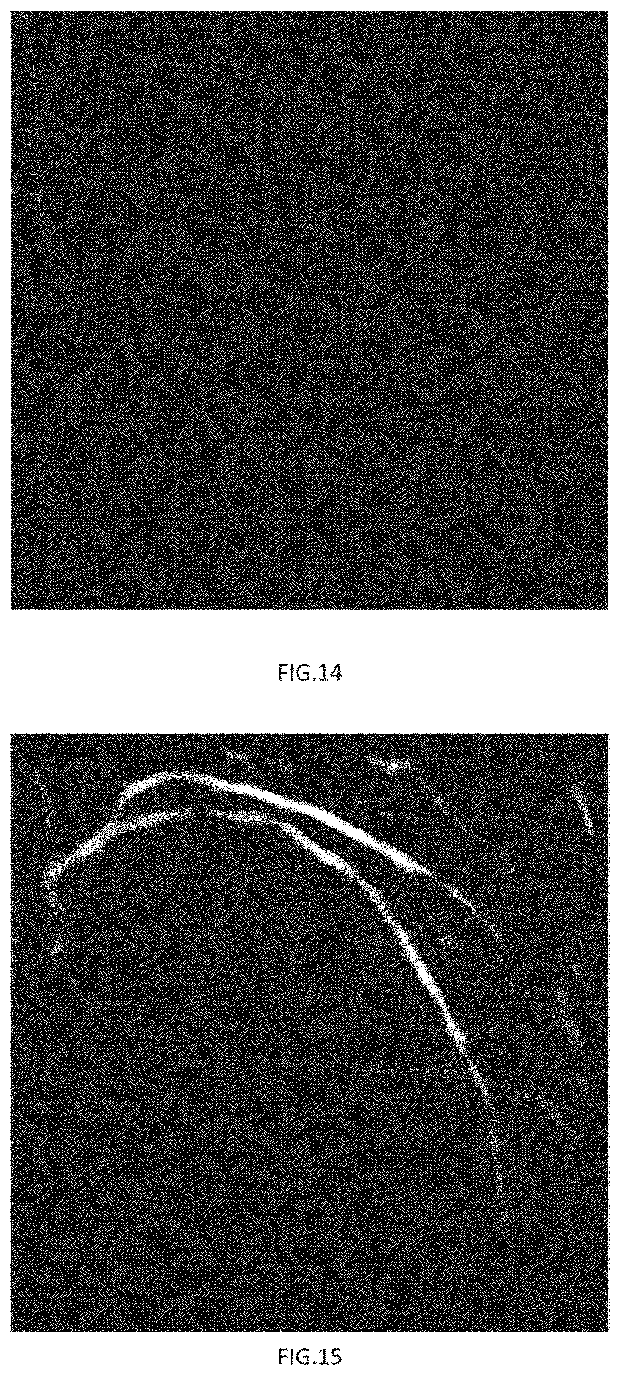 Patent US11779294 Figure 7 – Method, device and system for calculating microcirculation indicator based on image and pressure sensor