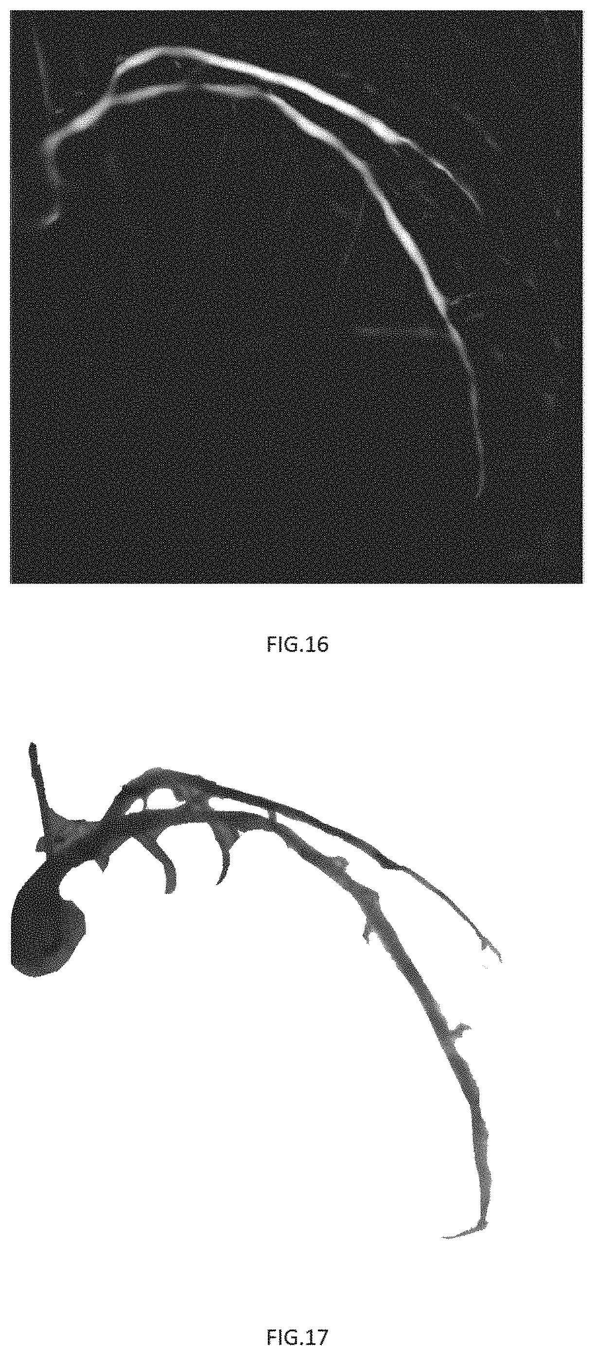 Patent US11779294 Figure 8 – Method, device and system for calculating microcirculation indicator based on image and pressure sensor