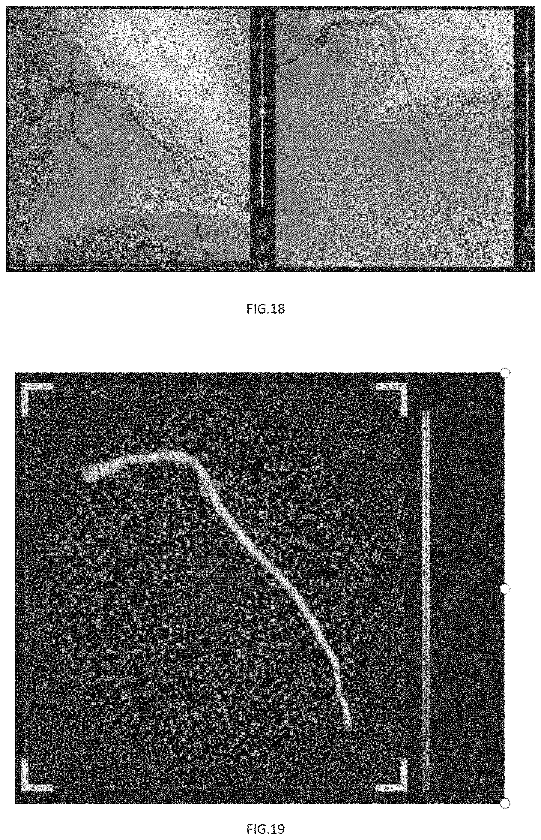 Patent US11779294 Figure 9 – Method, device and system for calculating microcirculation indicator based on image and pressure sensor