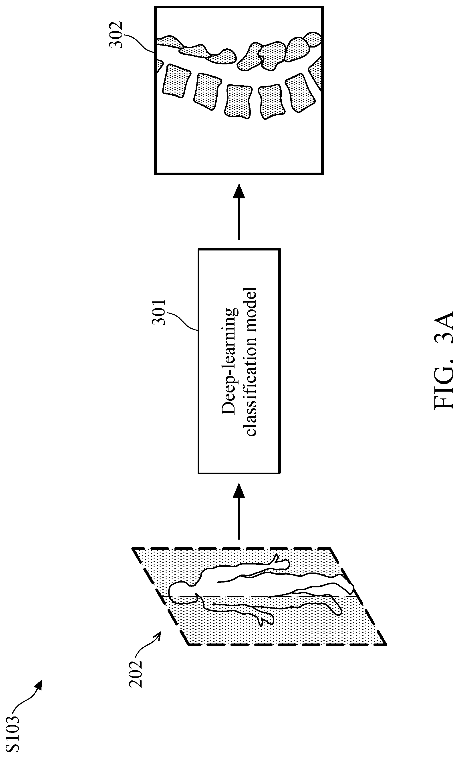 Patent US11779295 Figure 3 – Method and system of vertebral compression fracture detection
