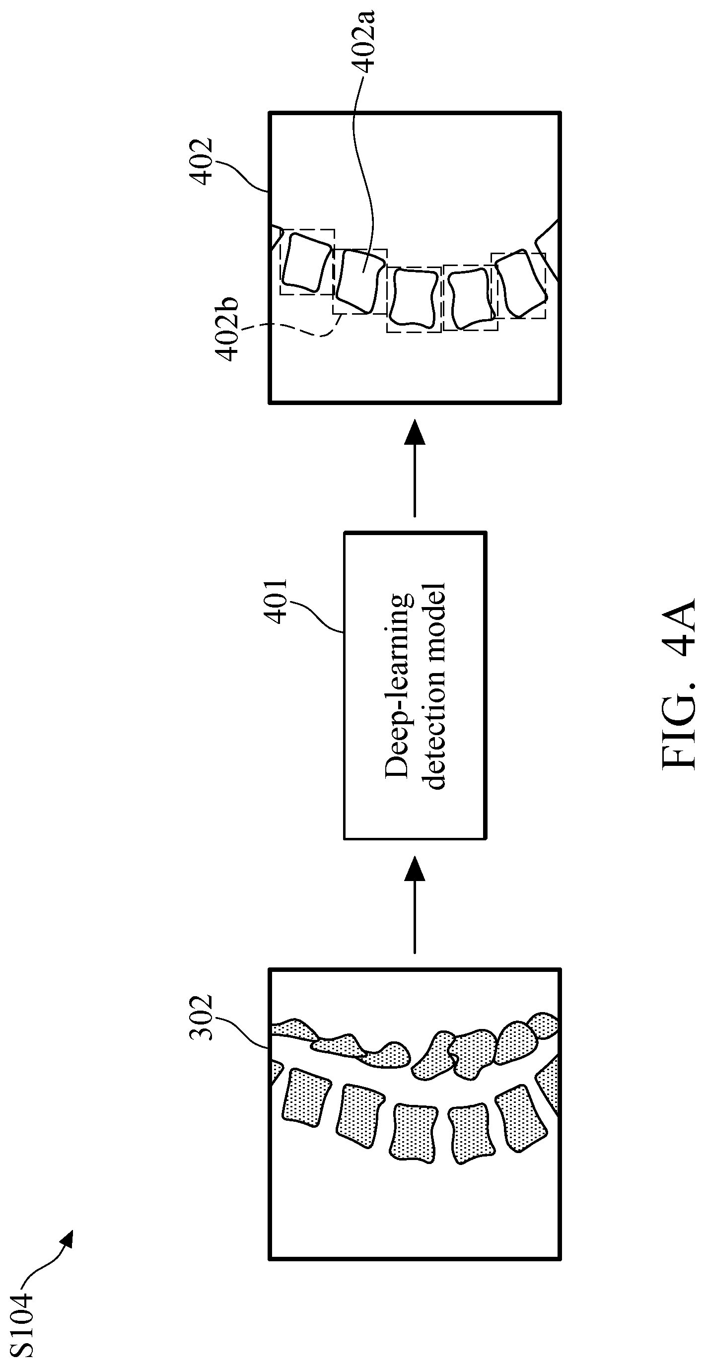 Patent US11779295 Figure 5 – Method and system of vertebral compression fracture detection