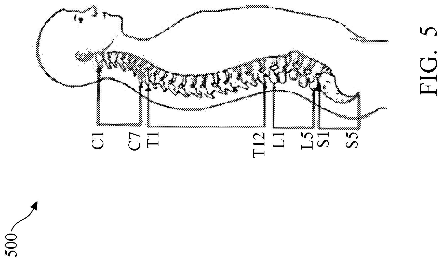 Patent US11779295 Figure 7 – Method and system of vertebral compression fracture detection
