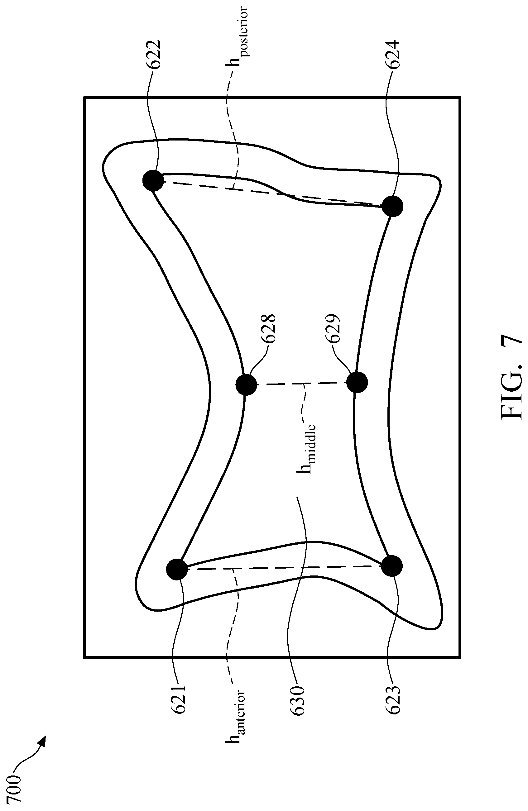 Patent US11779295 Figure 11 – Method and system of vertebral compression fracture detection