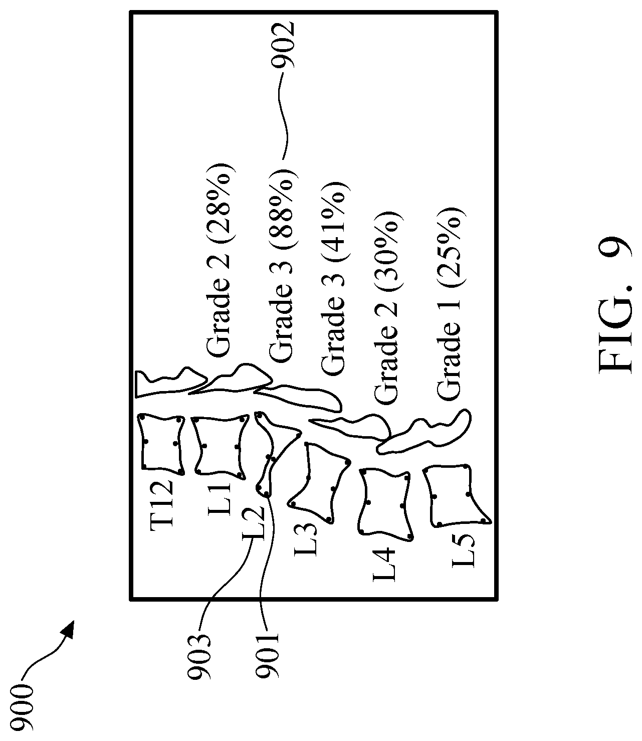 Patent US11779295 Figure 15 – Method and system of vertebral compression fracture detection